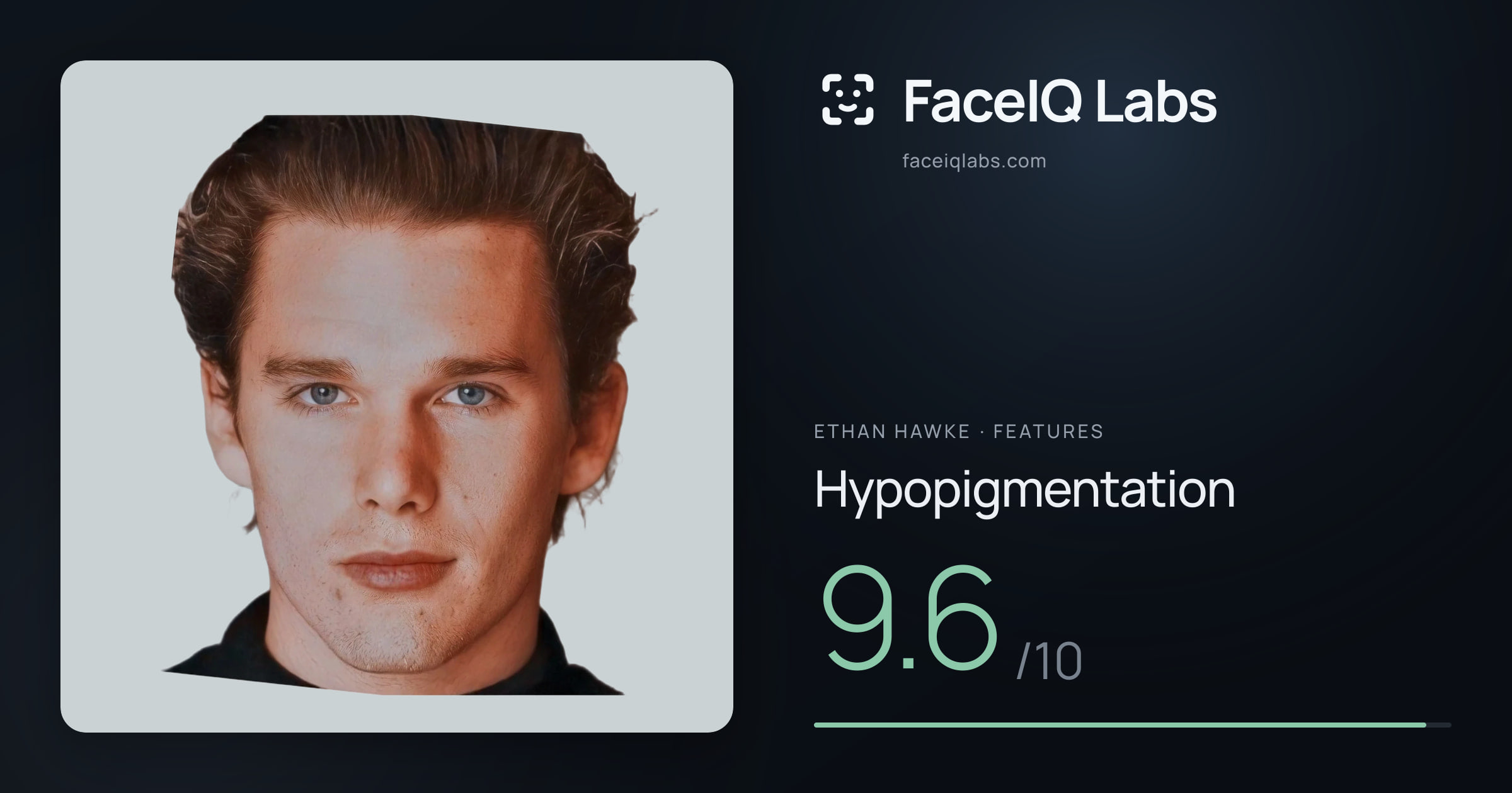 Ethan Hawke Hypopigmentation: 9.6/10, drawn on the photo