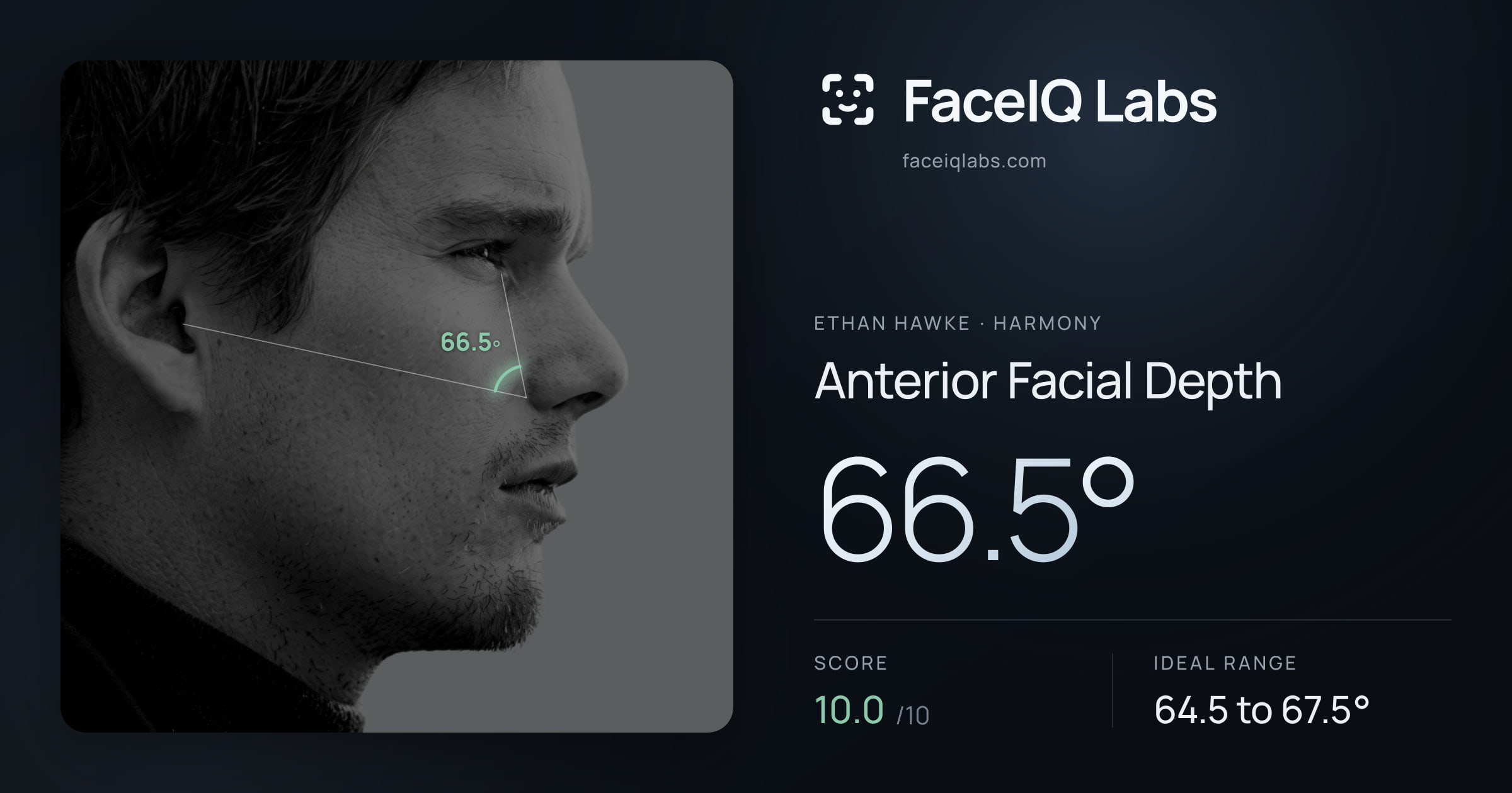 Ethan Hawke Anterior Facial Depth: 66.5°, drawn on the photo