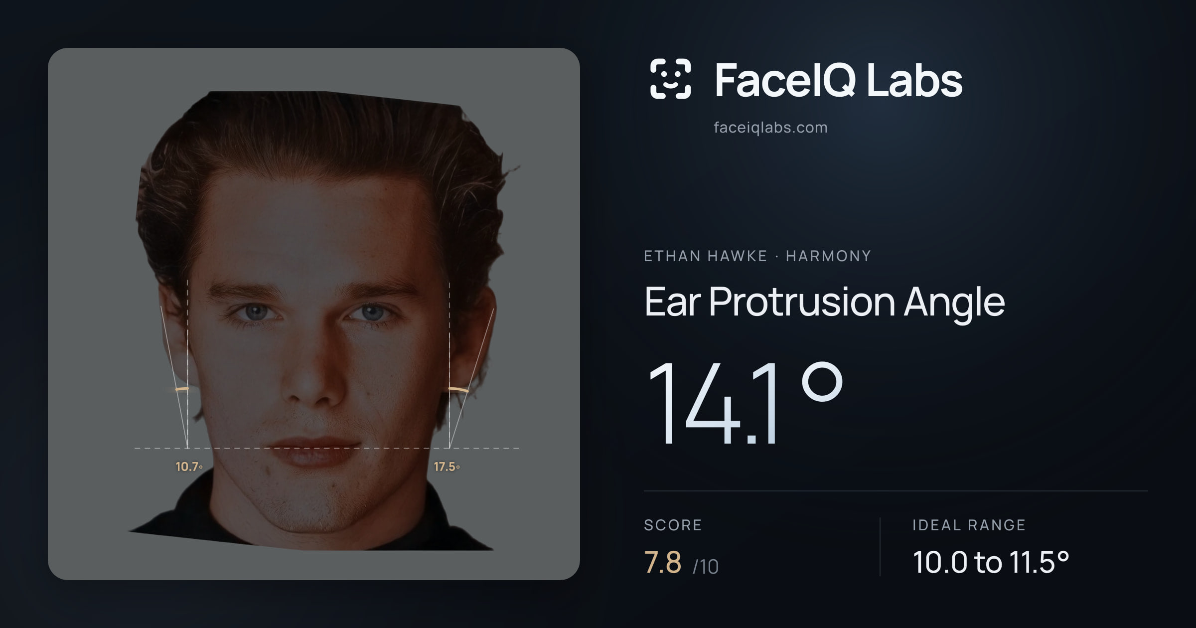 Ethan Hawke Ear Protrusion Angle: 14.1°, drawn on the photo