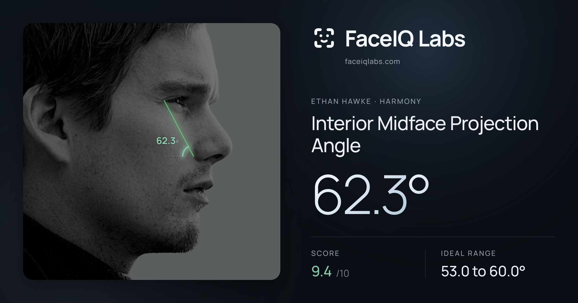 Ethan Hawke Interior Midface Projection Angle: 62.3°, drawn on the photo