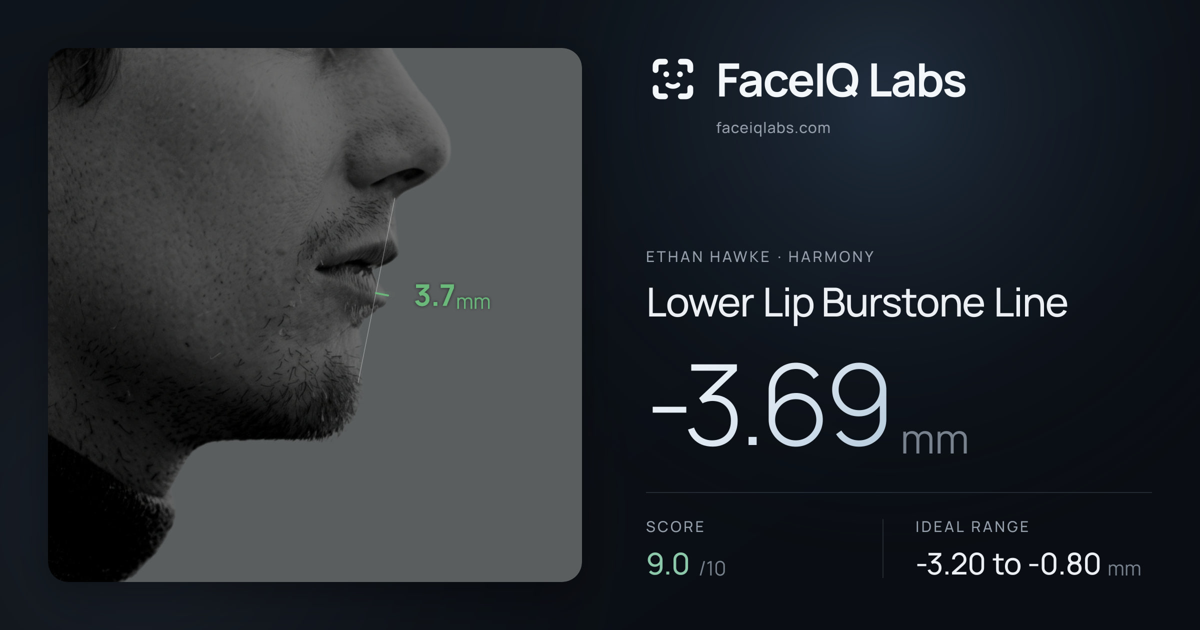 Ethan Hawke Lower Lip Burstone Line: -3.69mm, drawn on the photo