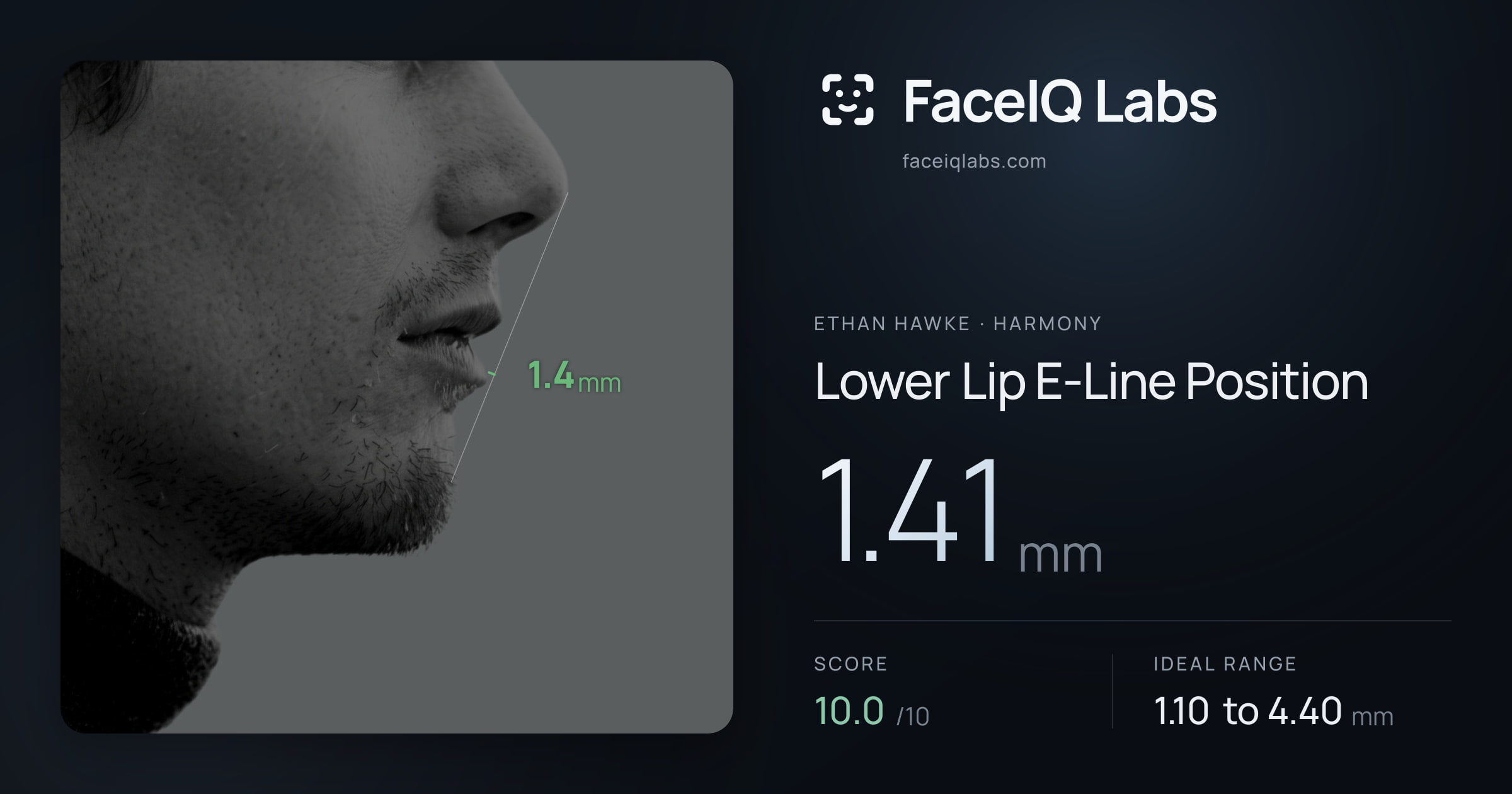 Ethan Hawke Lower Lip E-Line Position: 1.41mm, drawn on the photo