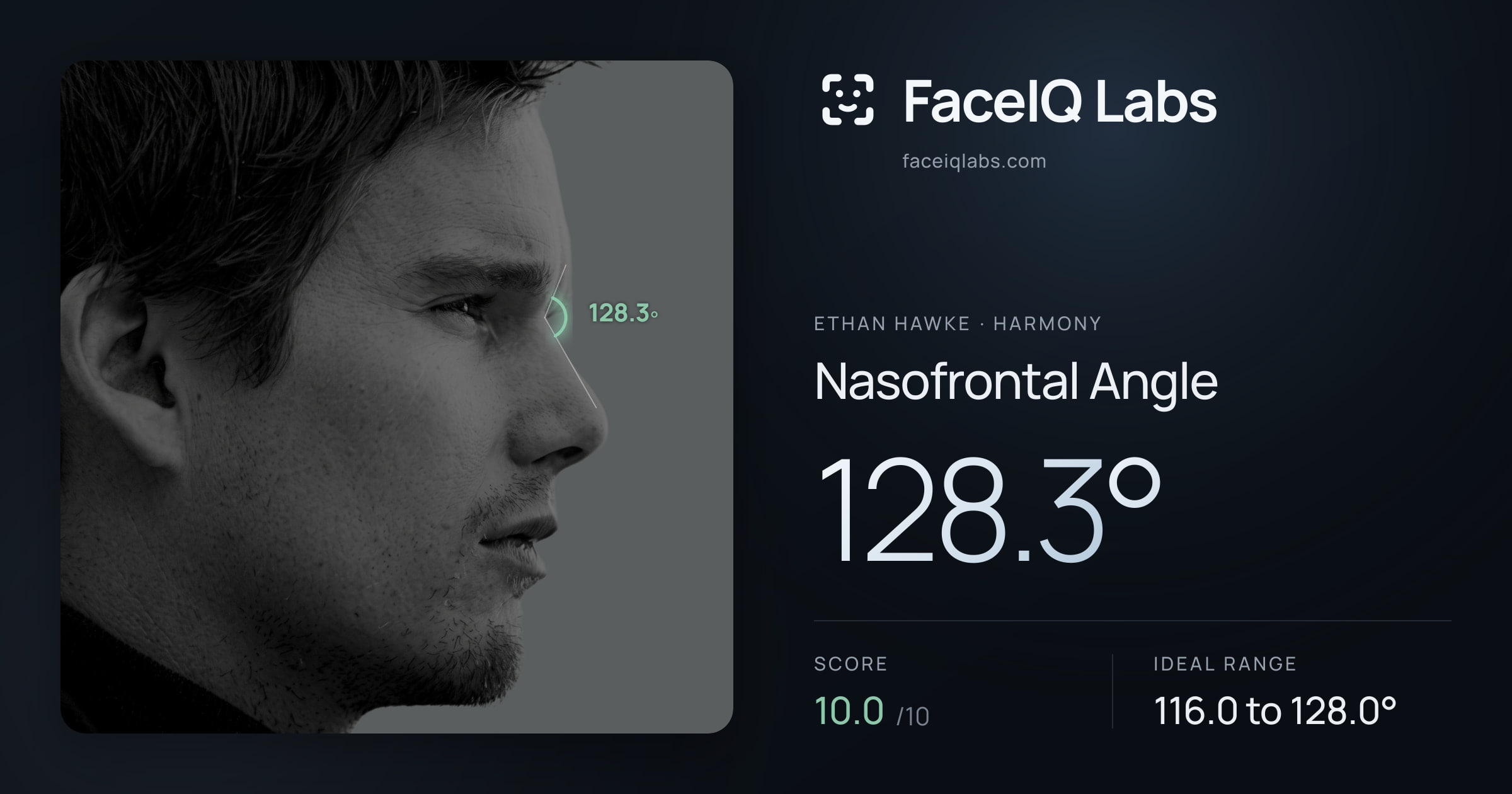 Ethan Hawke Nasofrontal Angle: 128.3°, drawn on the photo