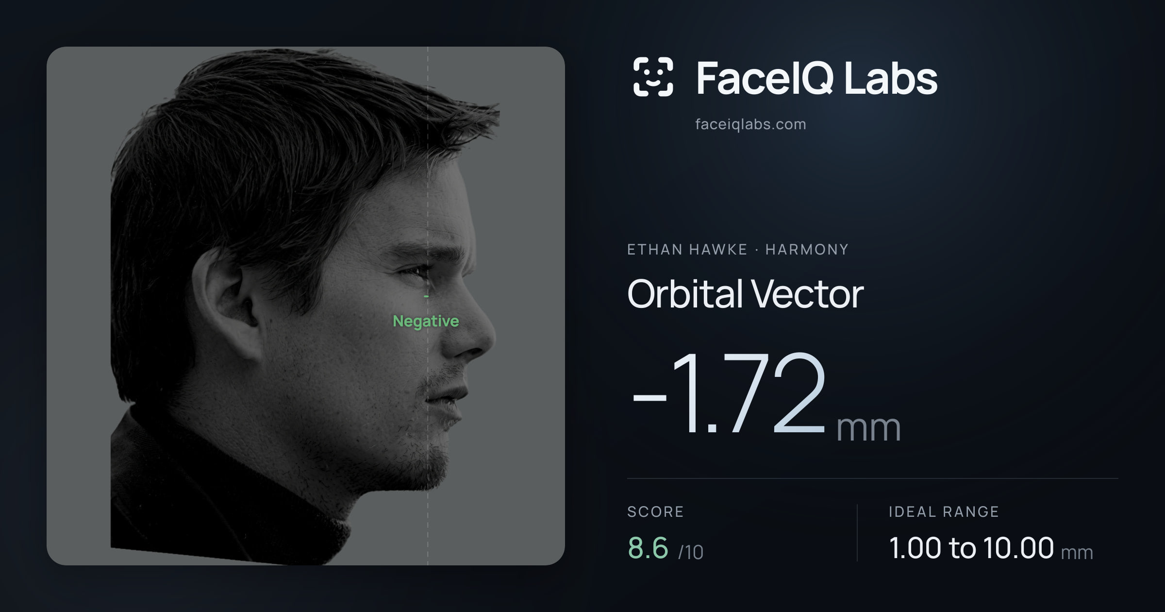 Ethan Hawke Orbital Vector: -1.72mm, drawn on the photo
