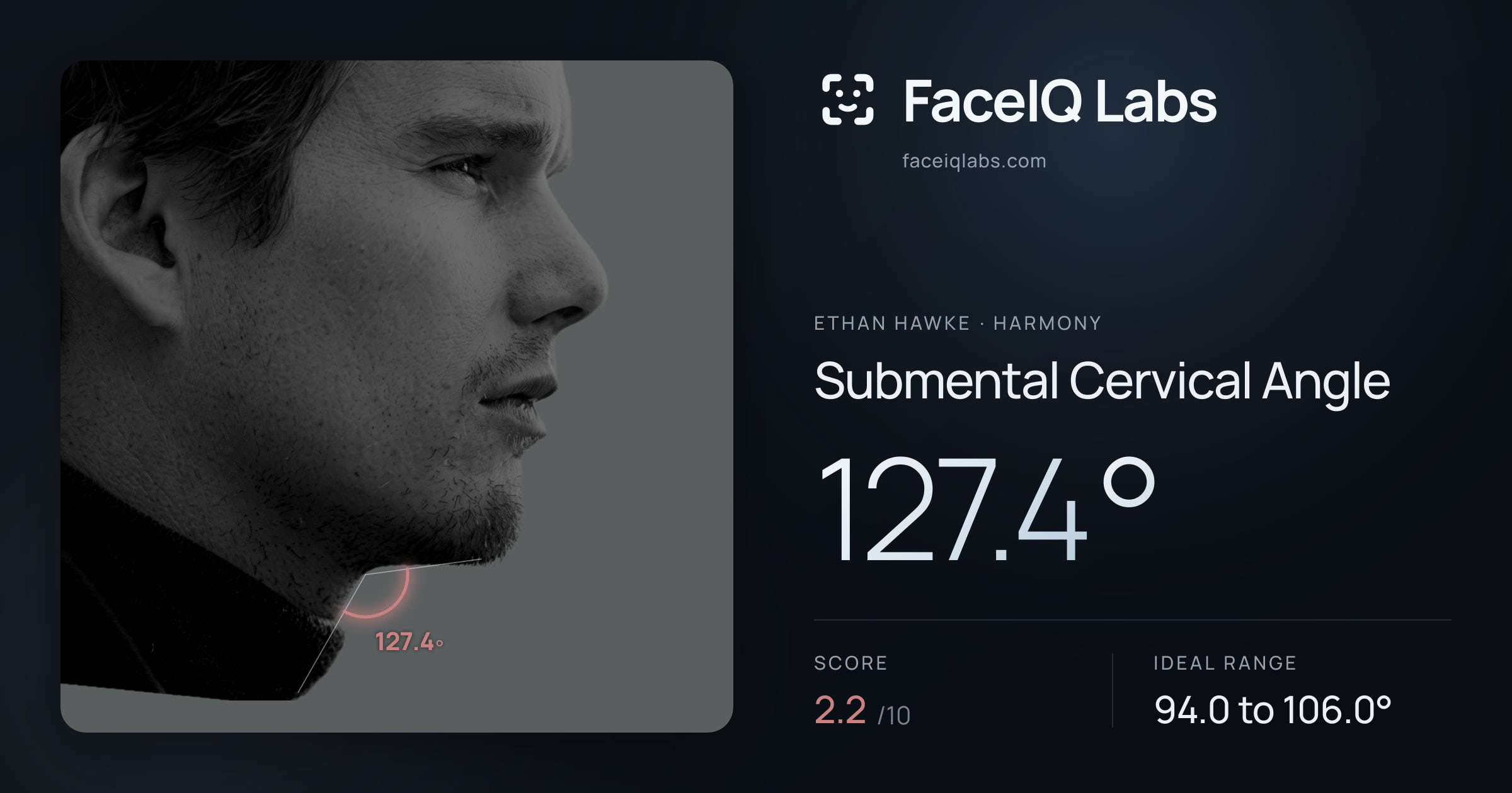 Ethan Hawke Submental Cervical Angle: 127.4°, drawn on the photo