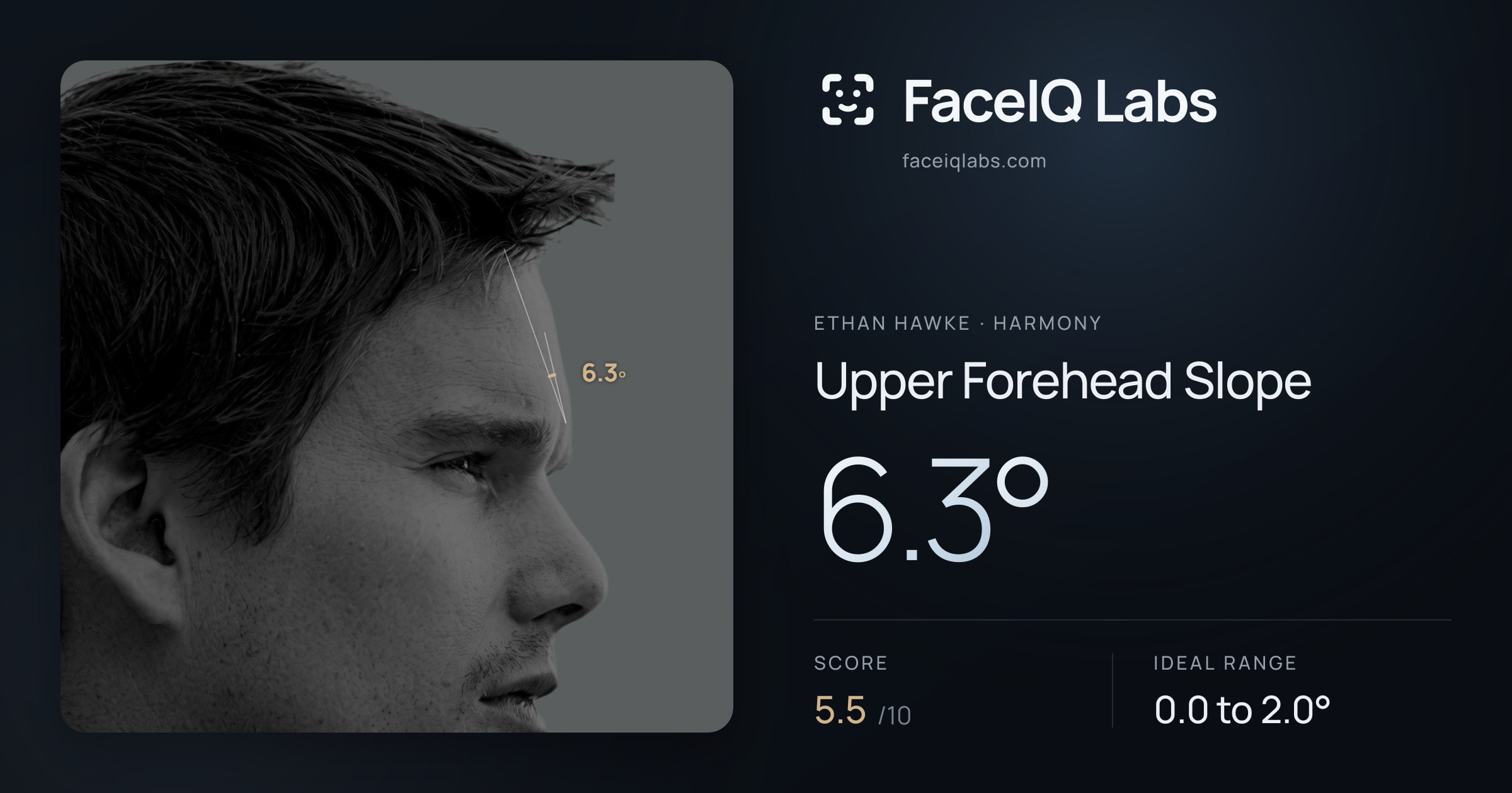 Ethan Hawke Upper Forehead Slope: 6.3°, drawn on the photo