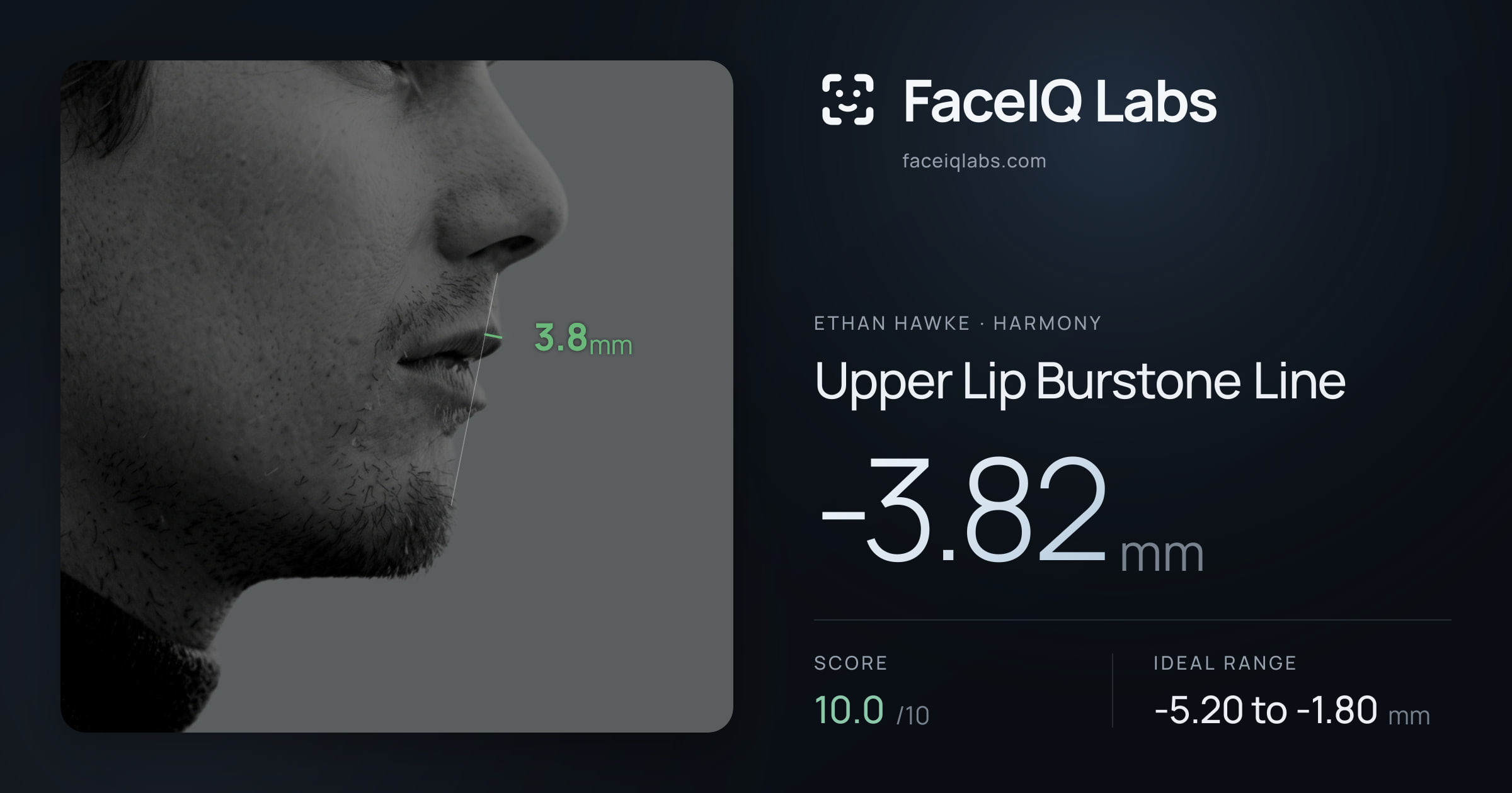 Ethan Hawke Upper Lip Burstone Line: -3.82mm, drawn on the photo