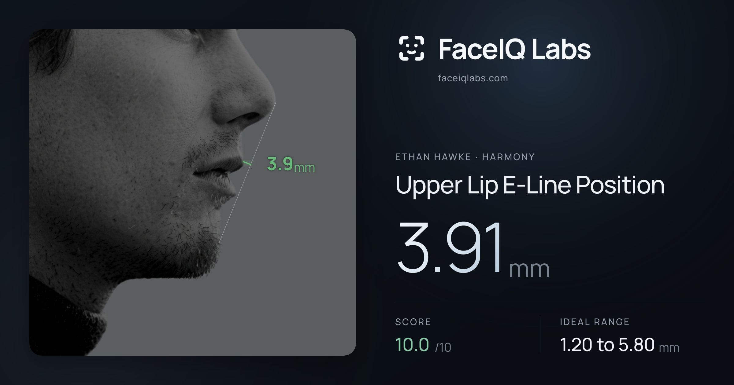 Ethan Hawke Upper Lip E-Line Position: 3.91mm, drawn on the photo