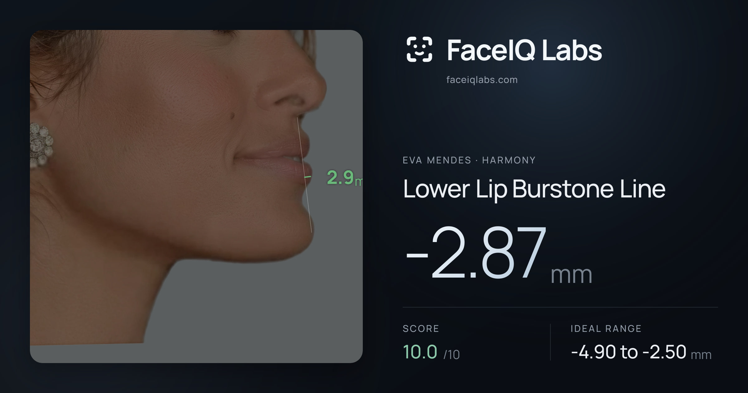 Eva Mendes Lower Lip Burstone Line: -2.87mm, drawn on the photo