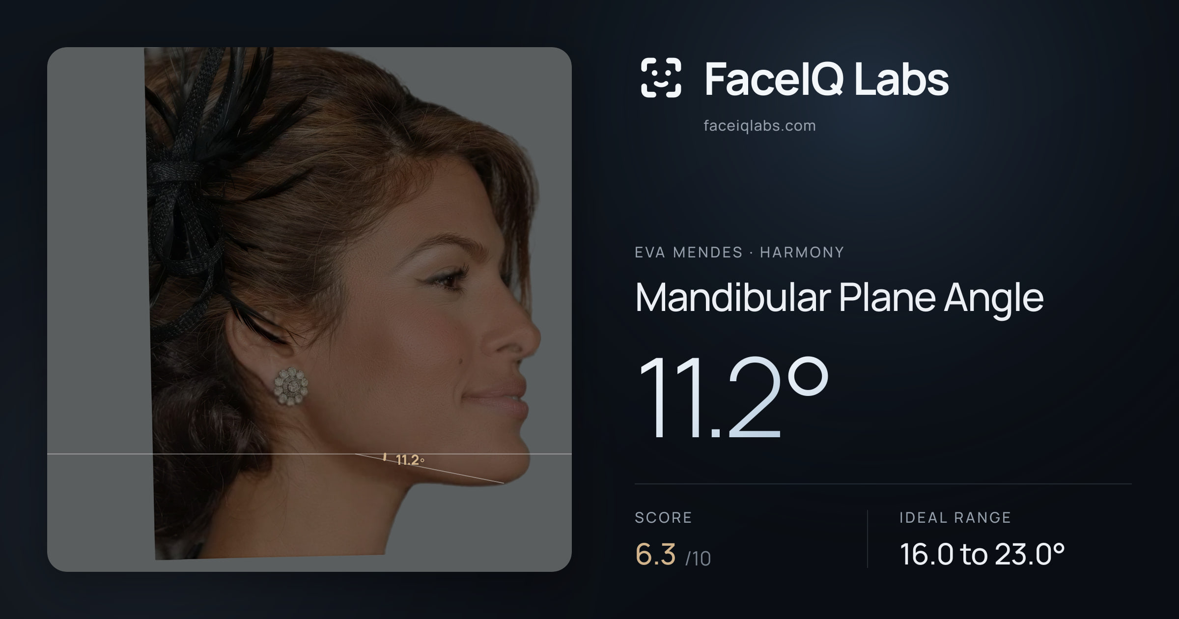Eva Mendes Mandibular Plane Angle: 11.2°, drawn on the photo