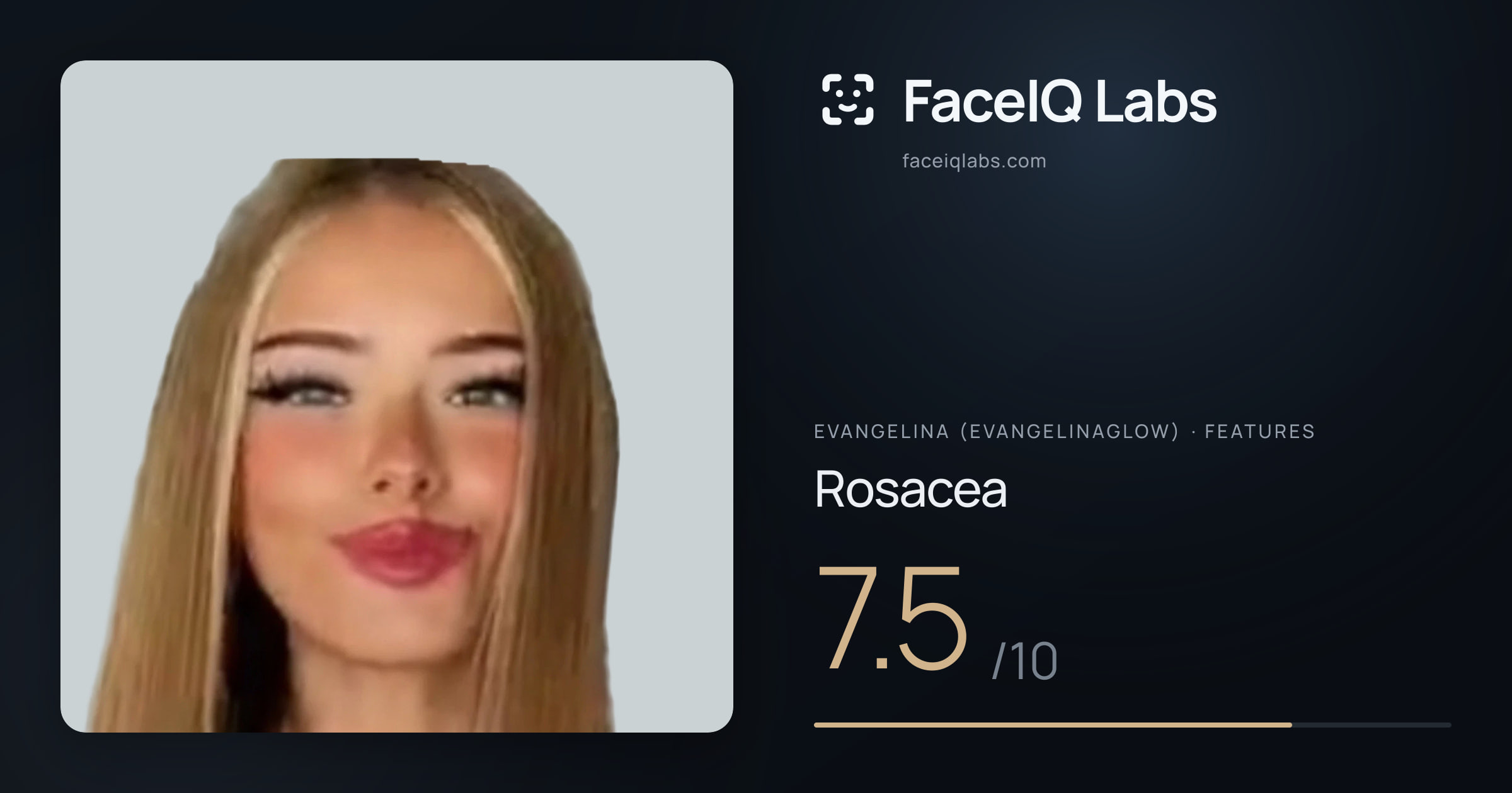 Evangelina (Evangelinaglow) Rosacea: 7.5/10, drawn on the photo