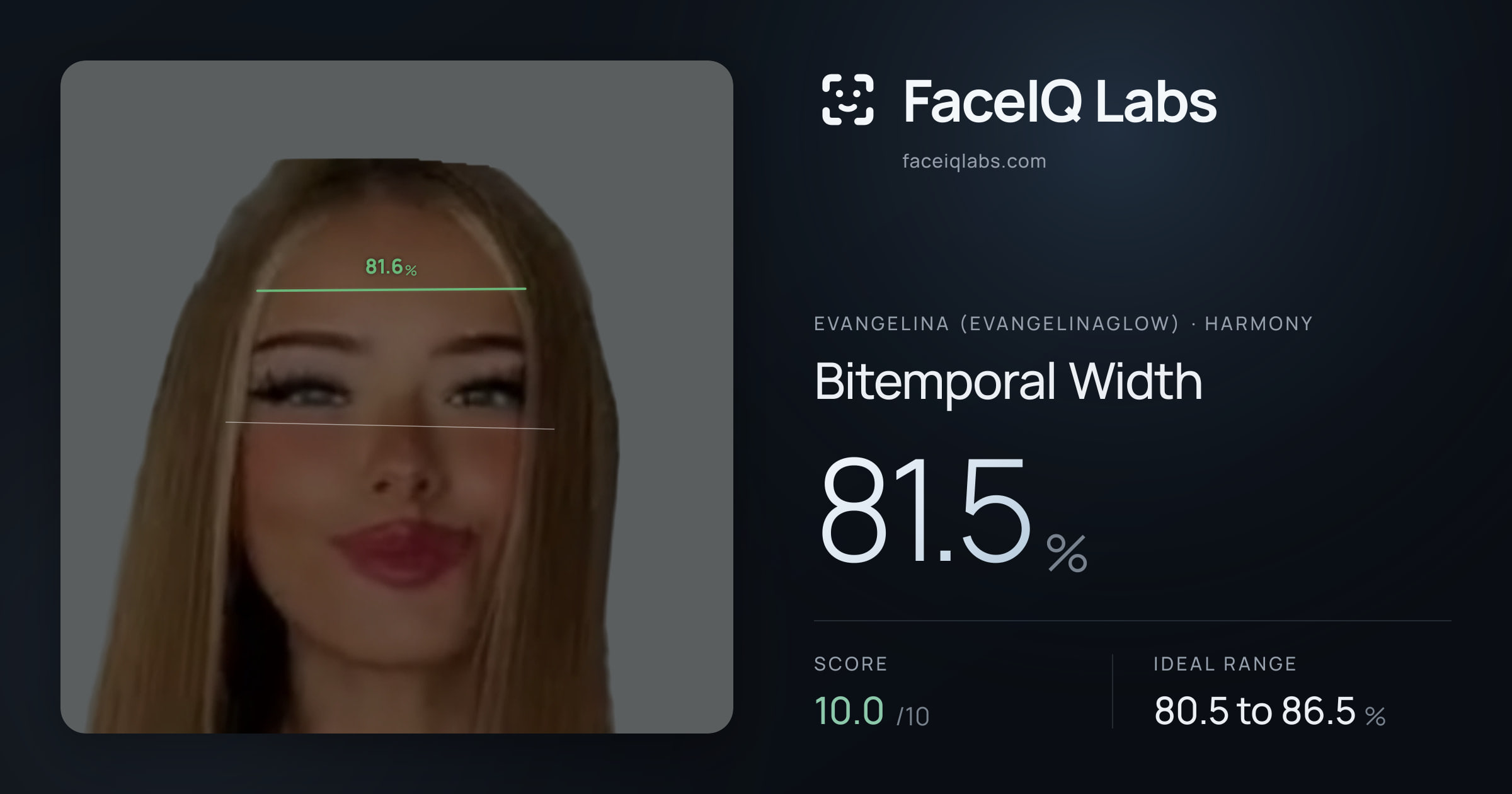 Evangelina (Evangelinaglow) Bitemporal Width: 81.5%, drawn on the photo