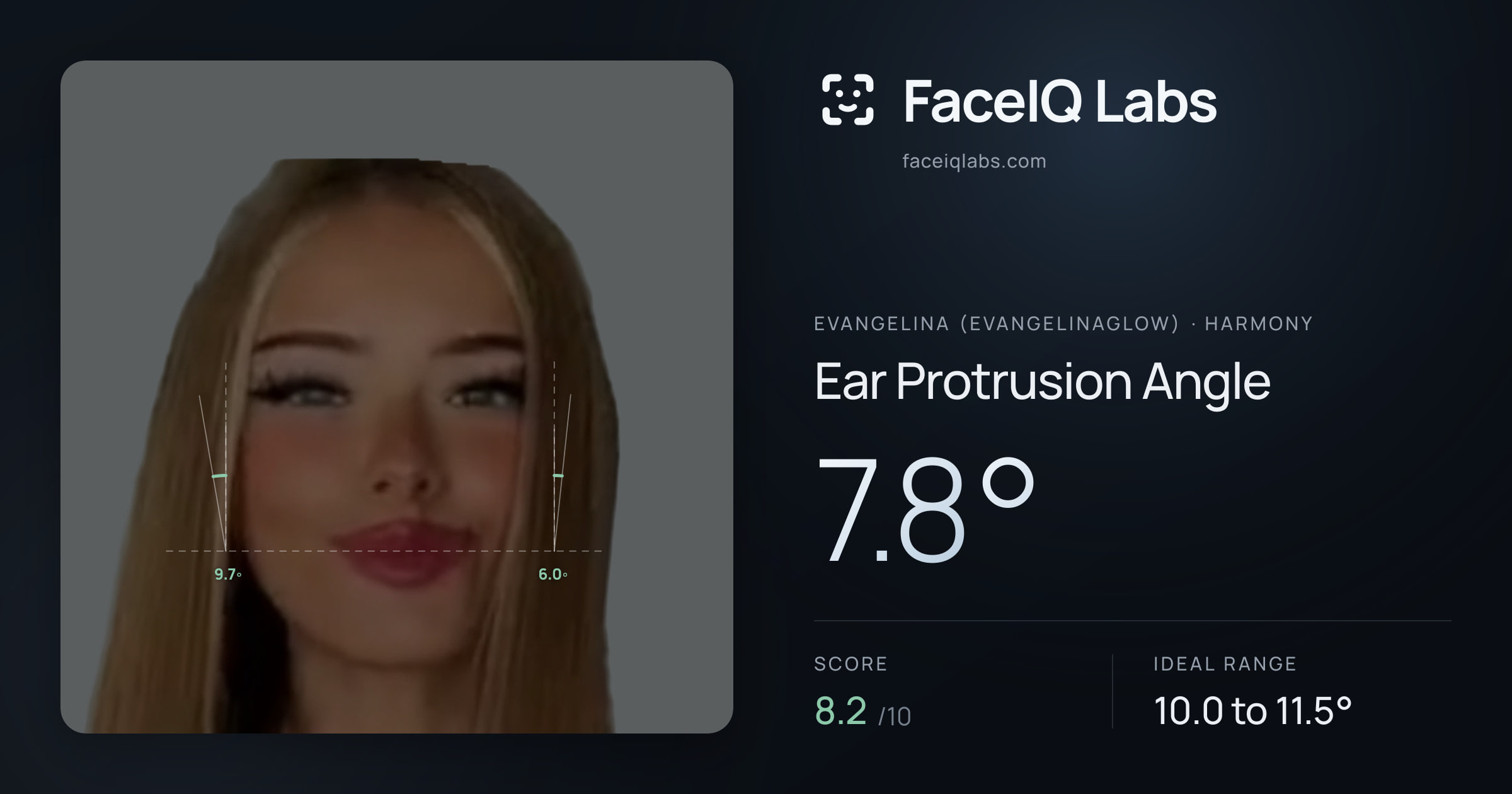 Evangelina (Evangelinaglow) Ear Protrusion Angle: 7.8°, drawn on the photo