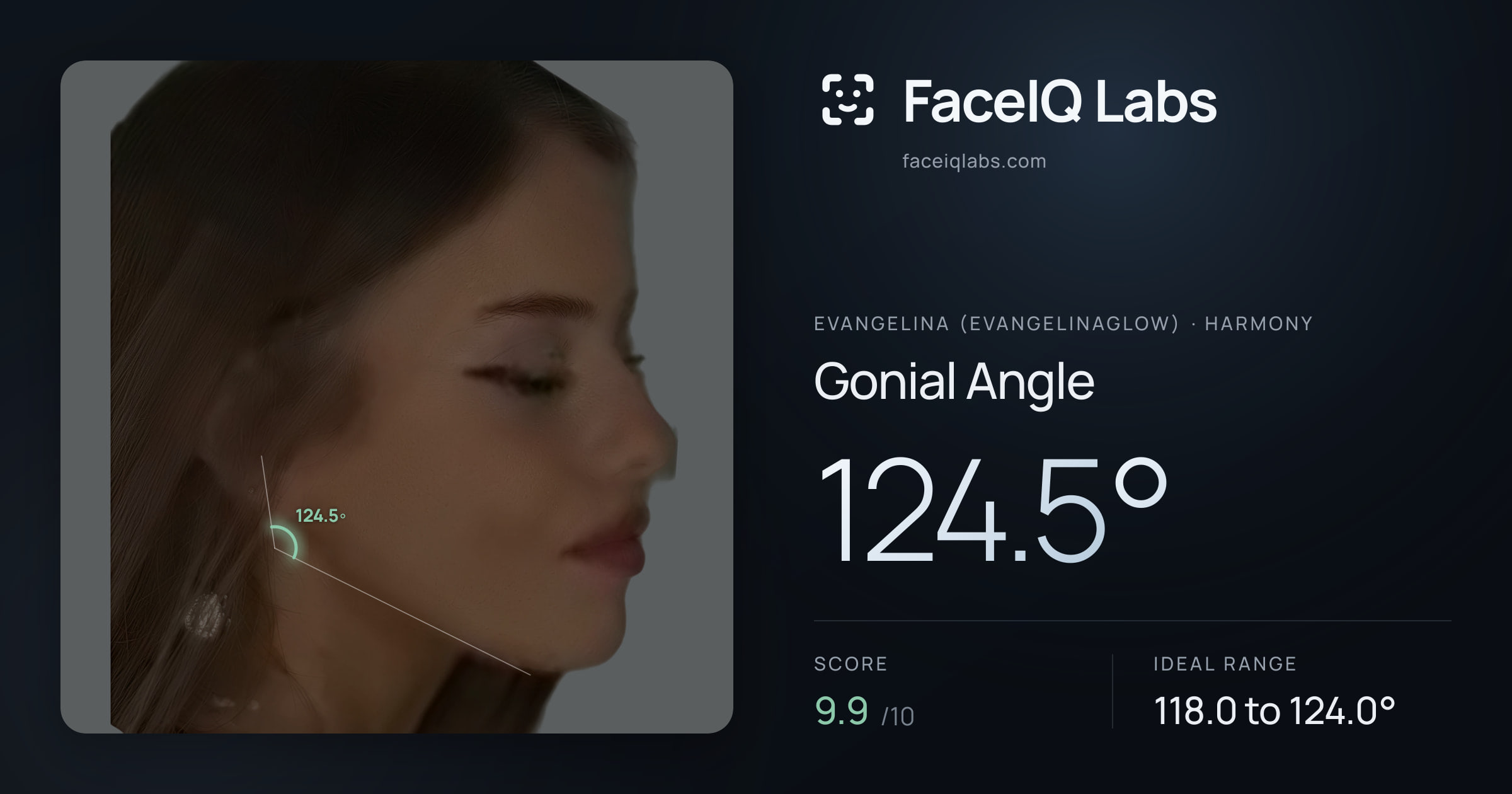 Evangelina (Evangelinaglow) Gonial Angle: 124.5°, drawn on the photo