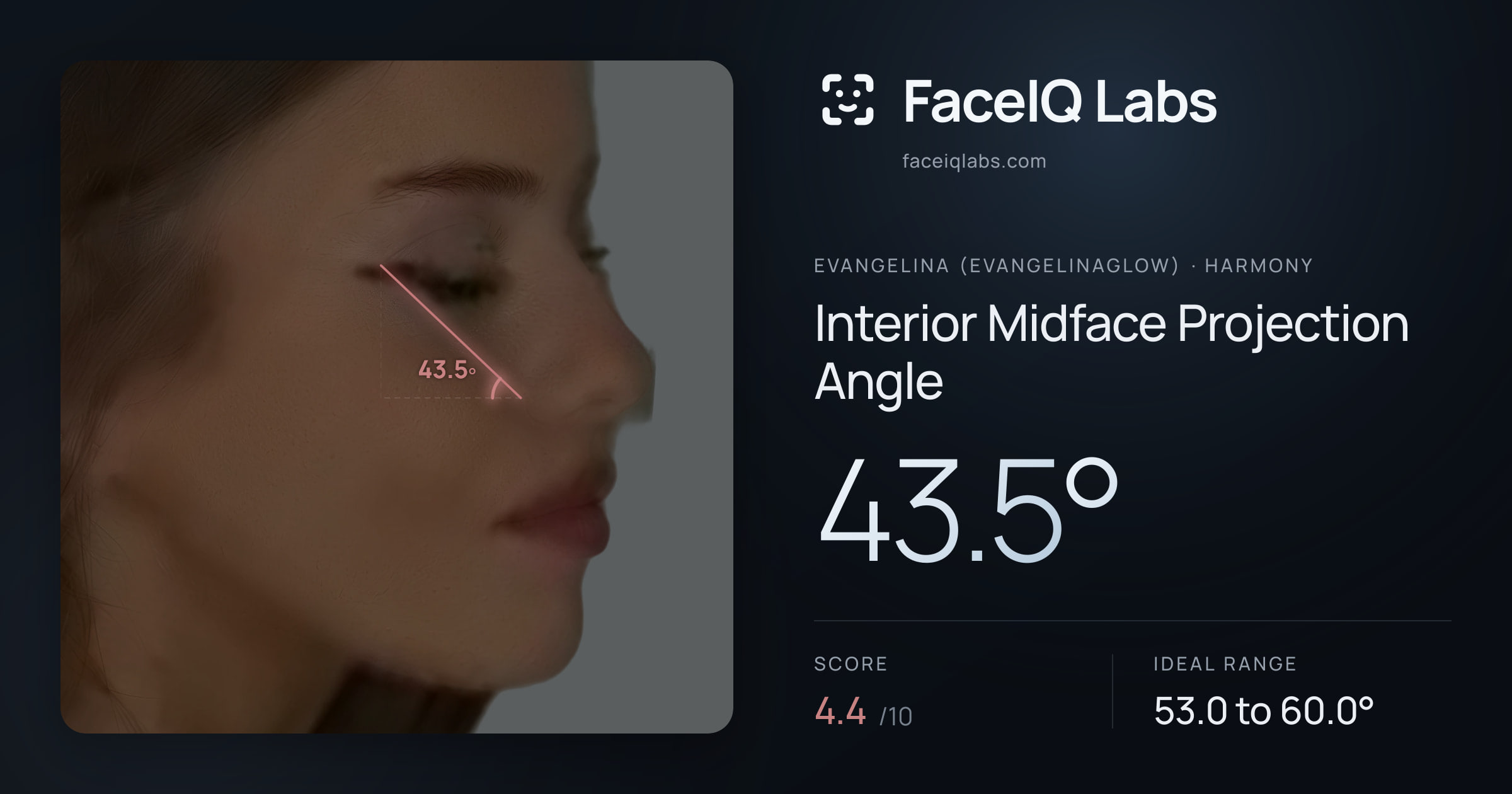 Evangelina (Evangelinaglow) Interior Midface Projection Angle: 43.5°, drawn on the photo