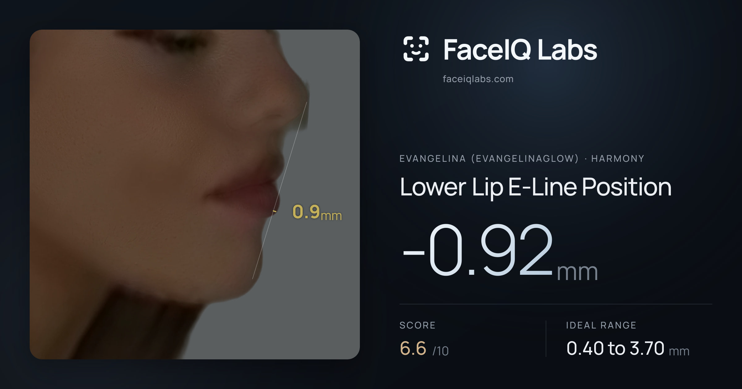 Evangelina (Evangelinaglow) Lower Lip E-Line Position: -0.92mm, drawn on the photo