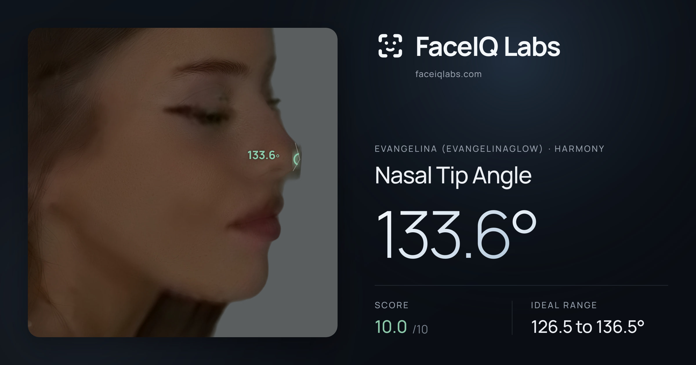 Evangelina (Evangelinaglow) Nasal Tip Angle: 133.6°, drawn on the photo