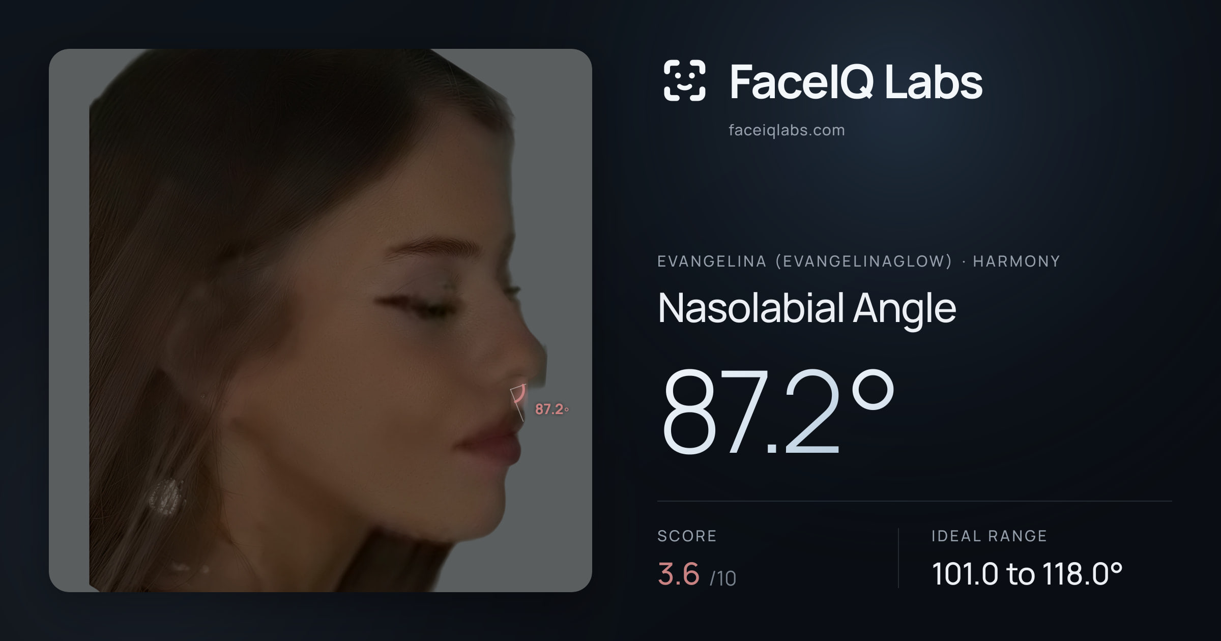 Evangelina (Evangelinaglow) Nasolabial Angle: 87.2°, drawn on the photo