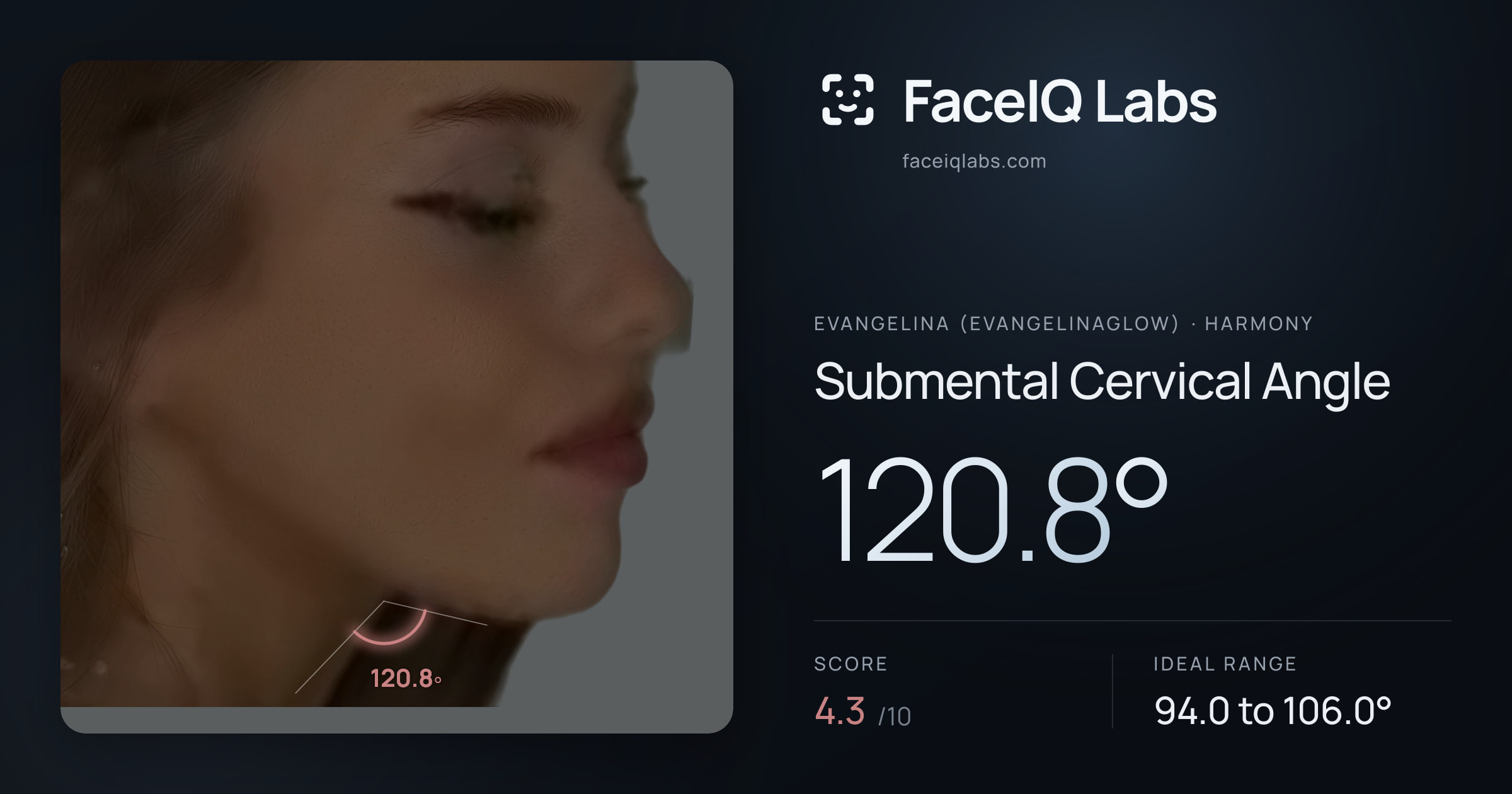 Evangelina (Evangelinaglow) Submental Cervical Angle: 120.8°, drawn on the photo