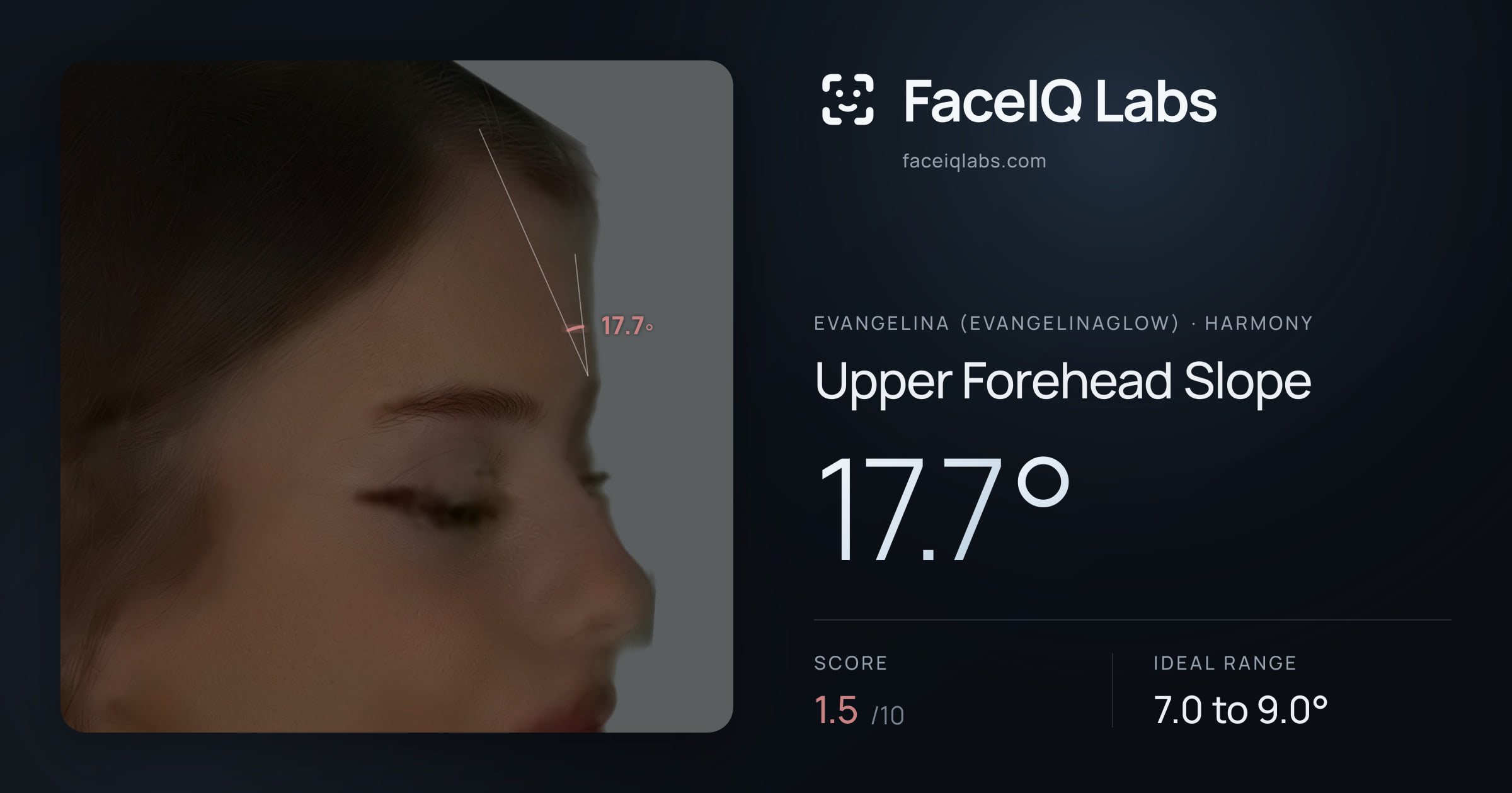Evangelina (Evangelinaglow) Upper Forehead Slope: 17.7°, drawn on the photo