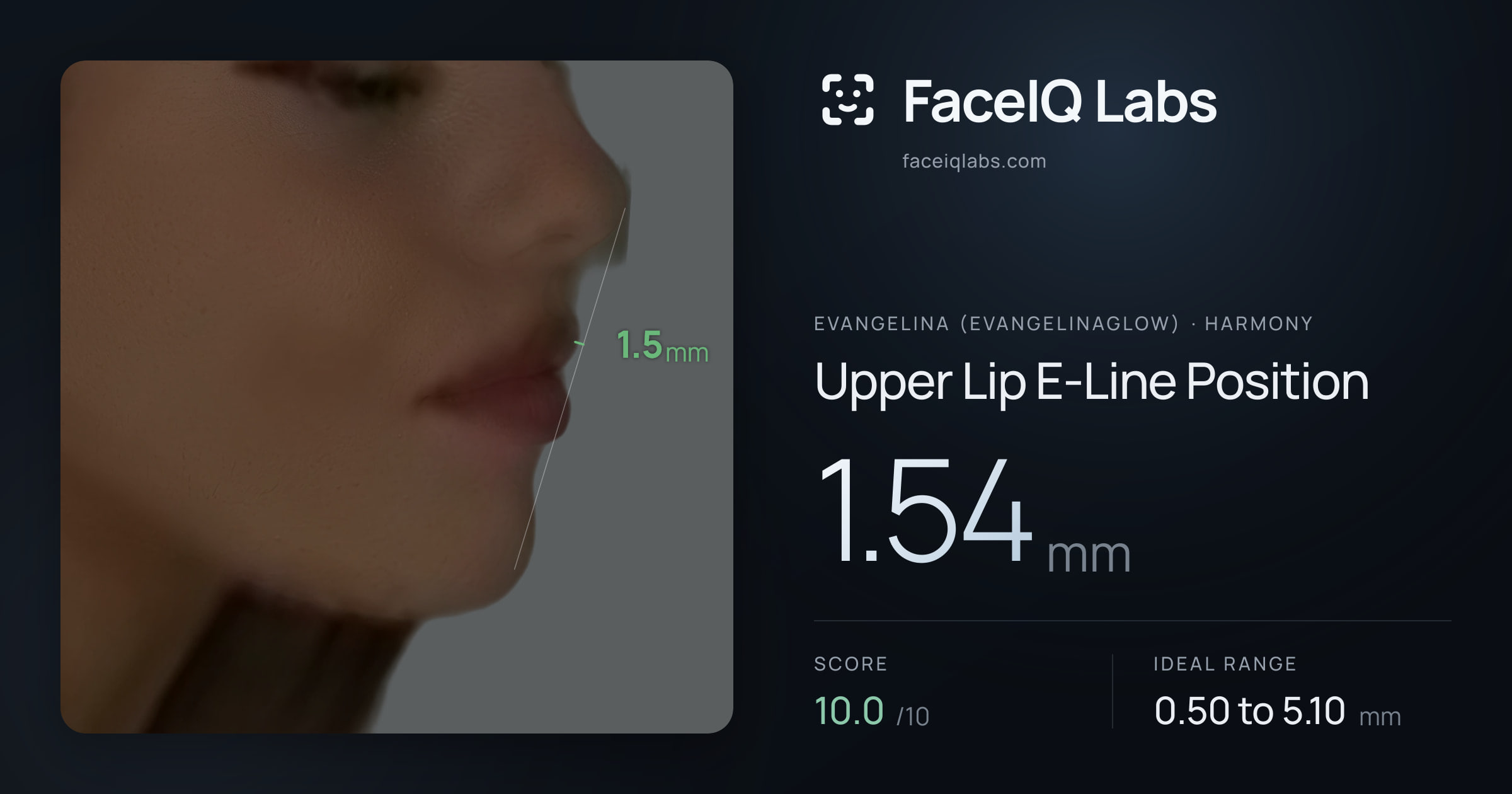 Evangelina (Evangelinaglow) Upper Lip E-Line Position: 1.54mm, drawn on the photo