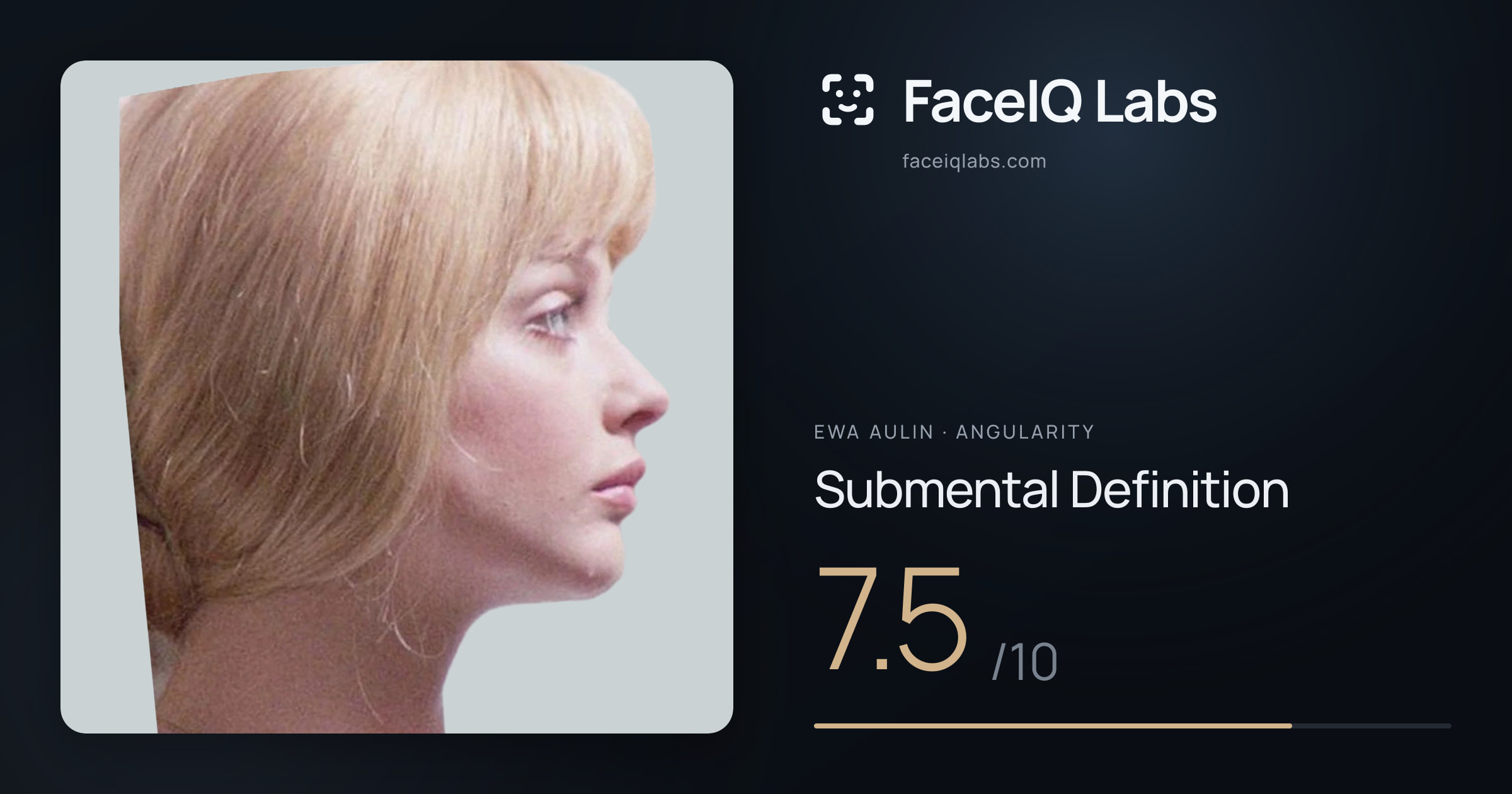 Ewa Aulin Submental Definition: 7.5/10, drawn on the photo