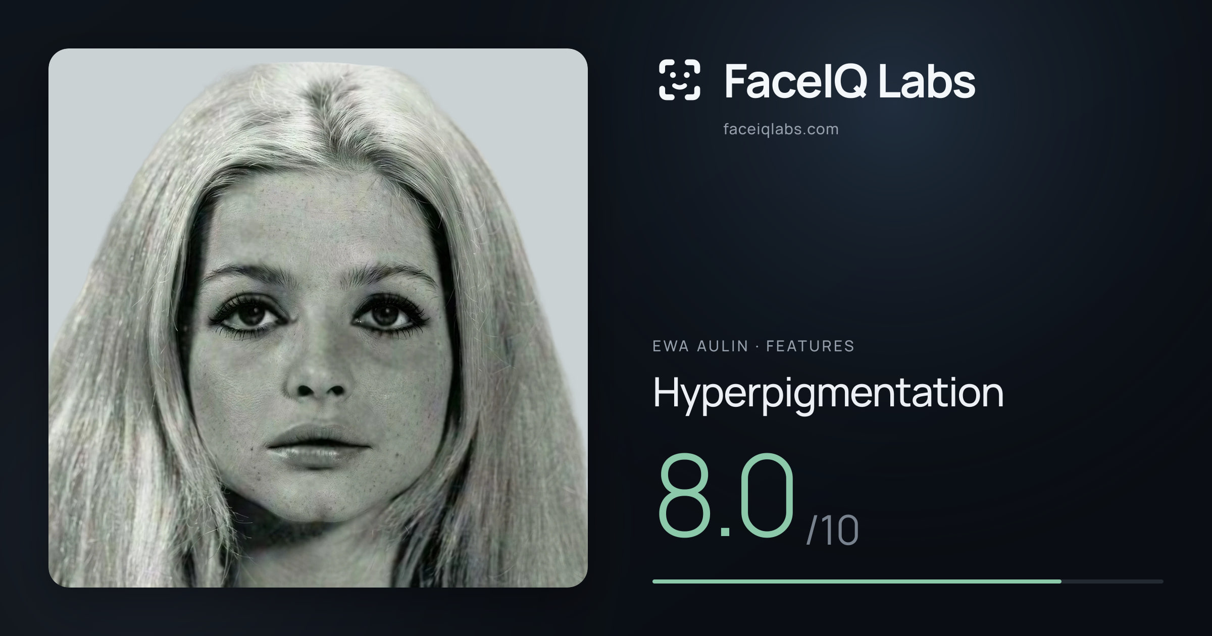 Ewa Aulin Hyperpigmentation: 8.0/10, drawn on the photo