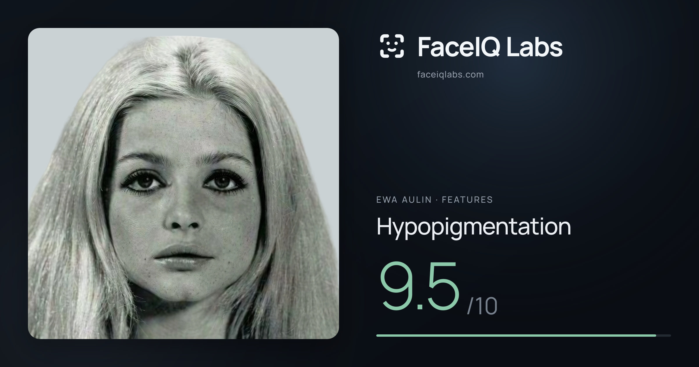 Ewa Aulin Hypopigmentation: 9.5/10, drawn on the photo