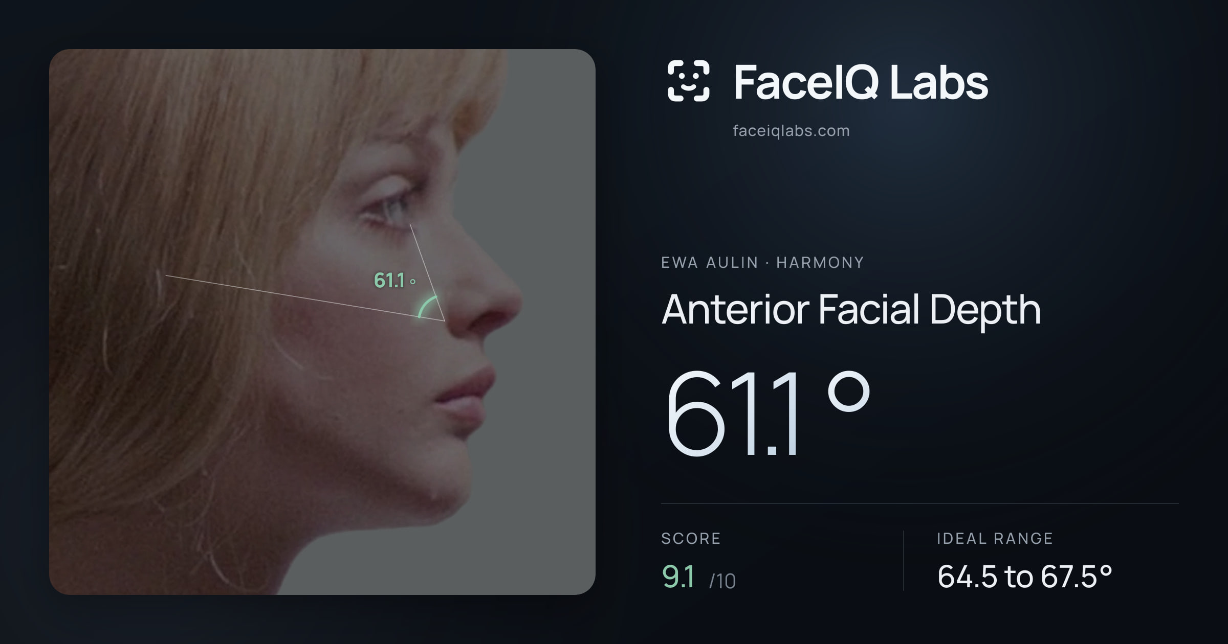 Ewa Aulin Anterior Facial Depth: 61.1°, drawn on the photo