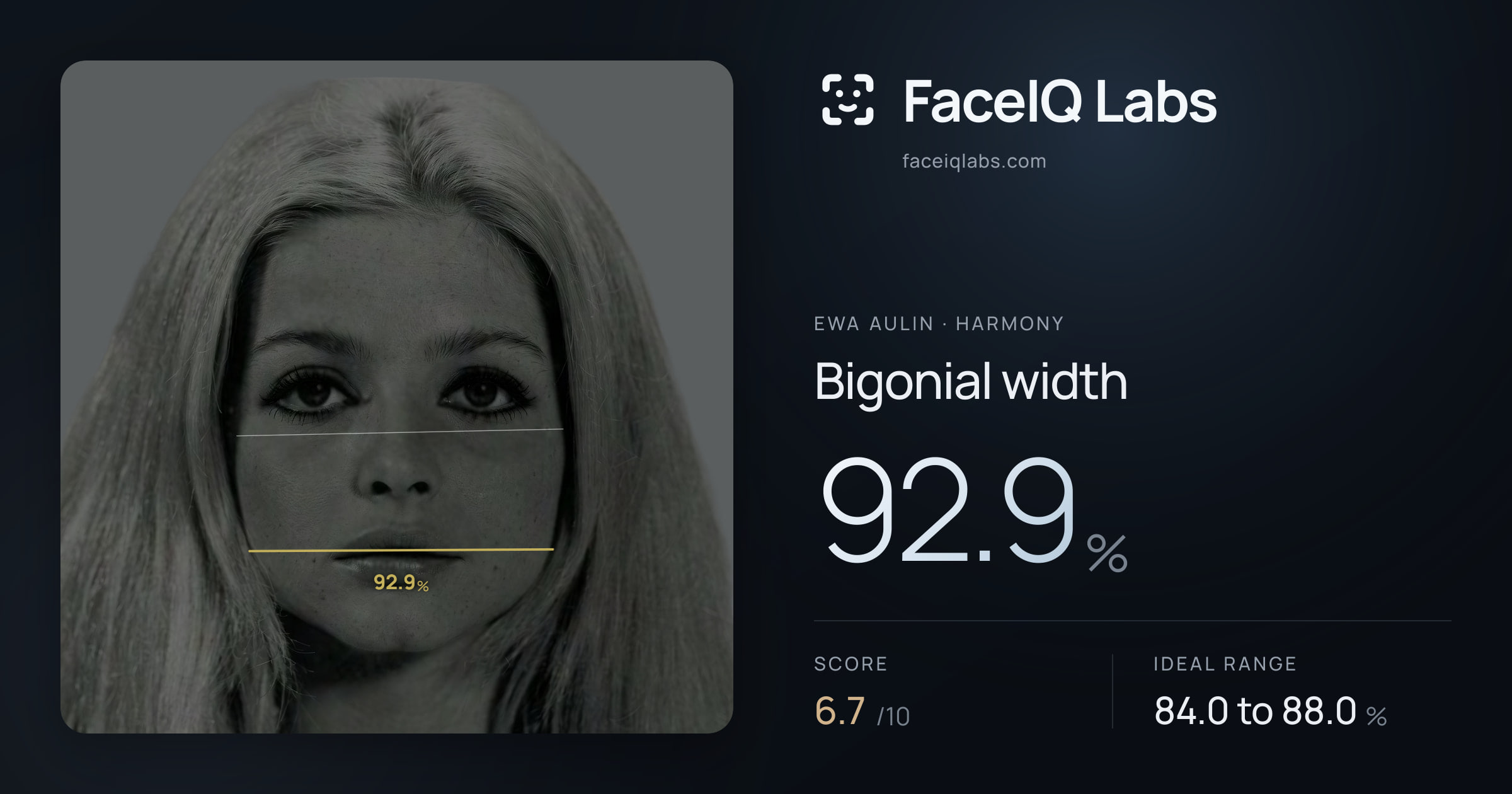 Ewa Aulin Bigonial width: 92.9%, drawn on the photo