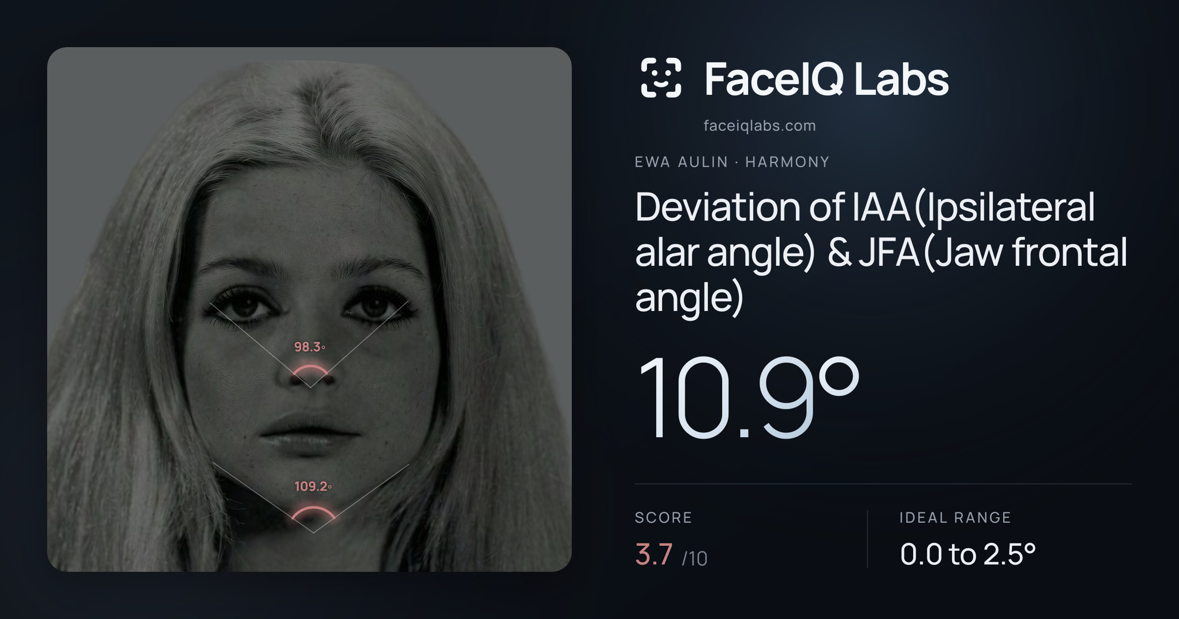 Ewa Aulin Deviation of IAA(Ipsilateral alar angle) & JFA(Jaw frontal angle): 10.9°, drawn on the photo