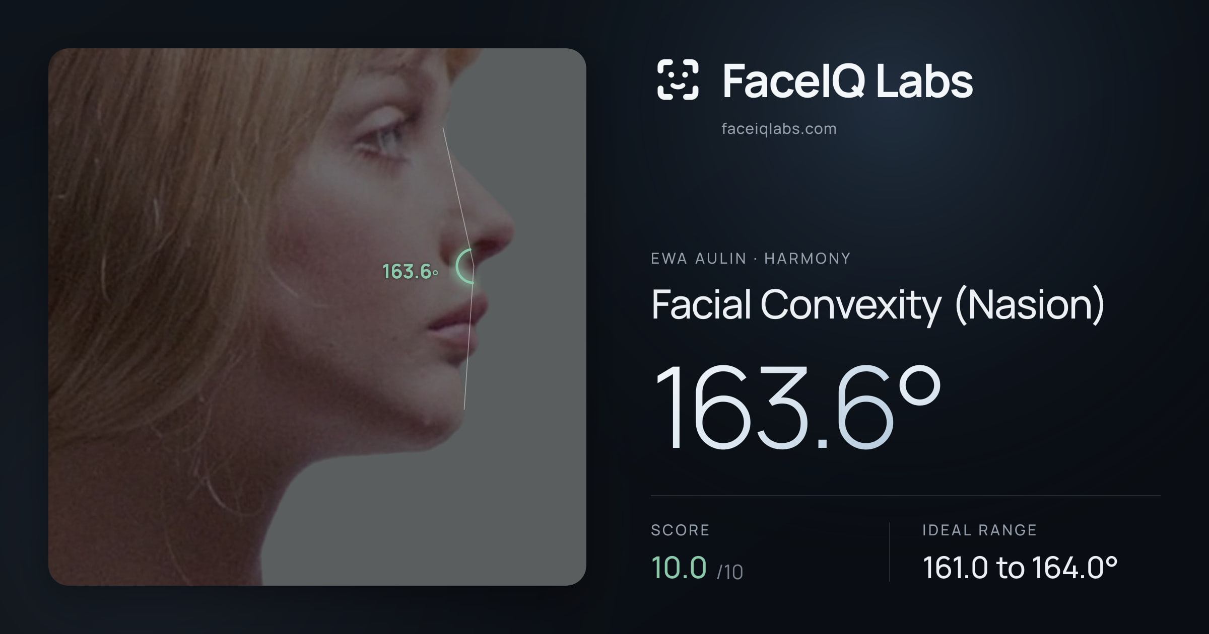 Ewa Aulin Facial Convexity (Nasion): 163.6°, drawn on the photo