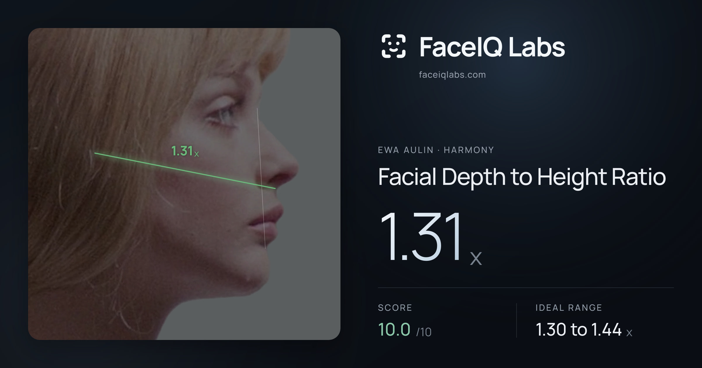 Ewa Aulin Facial Depth to Height Ratio: 1.31x, drawn on the photo