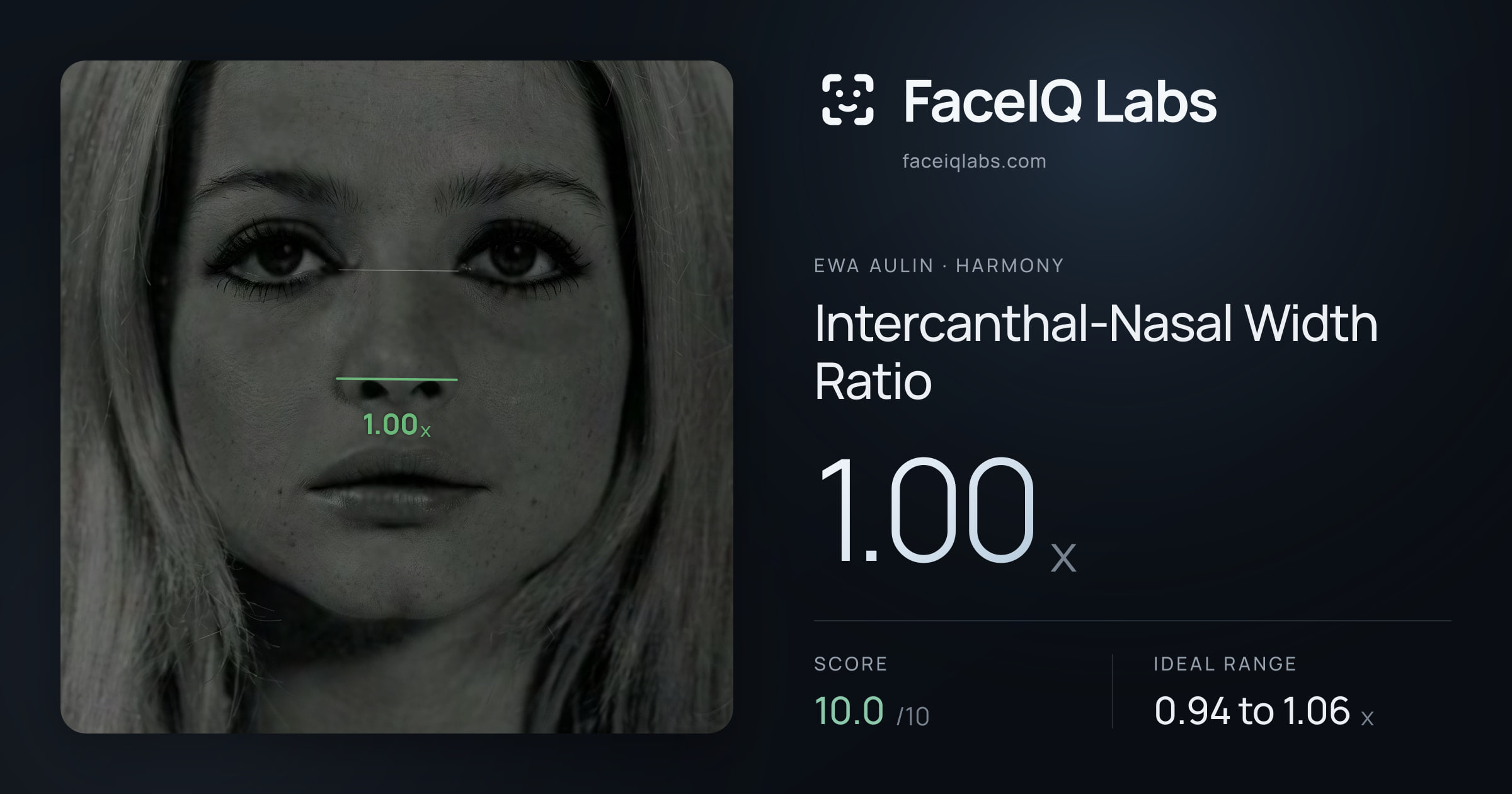 Ewa Aulin Intercanthal-Nasal Width Ratio: 1.00x, drawn on the photo
