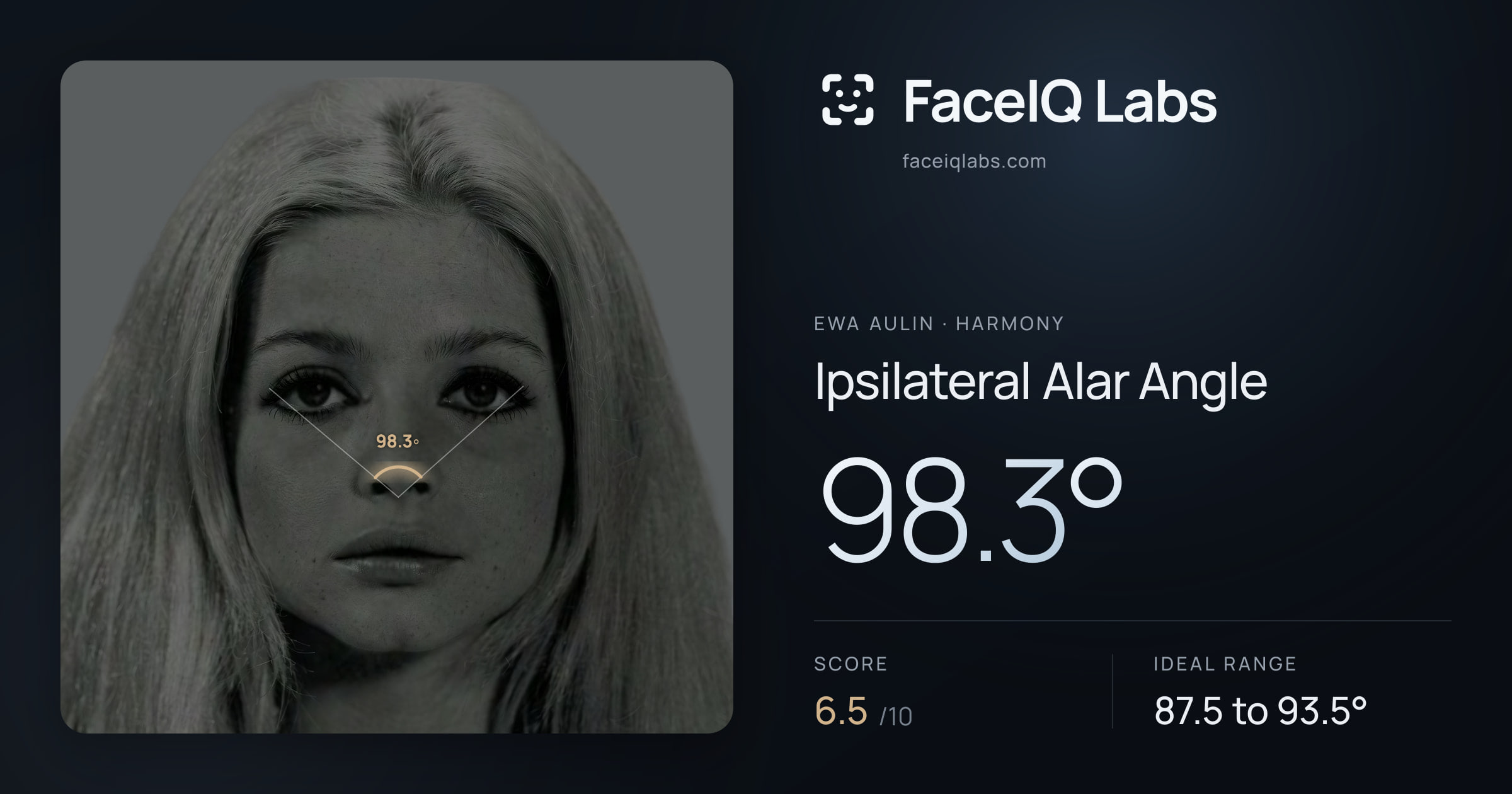 Ewa Aulin Ipsilateral Alar Angle: 98.3°, drawn on the photo