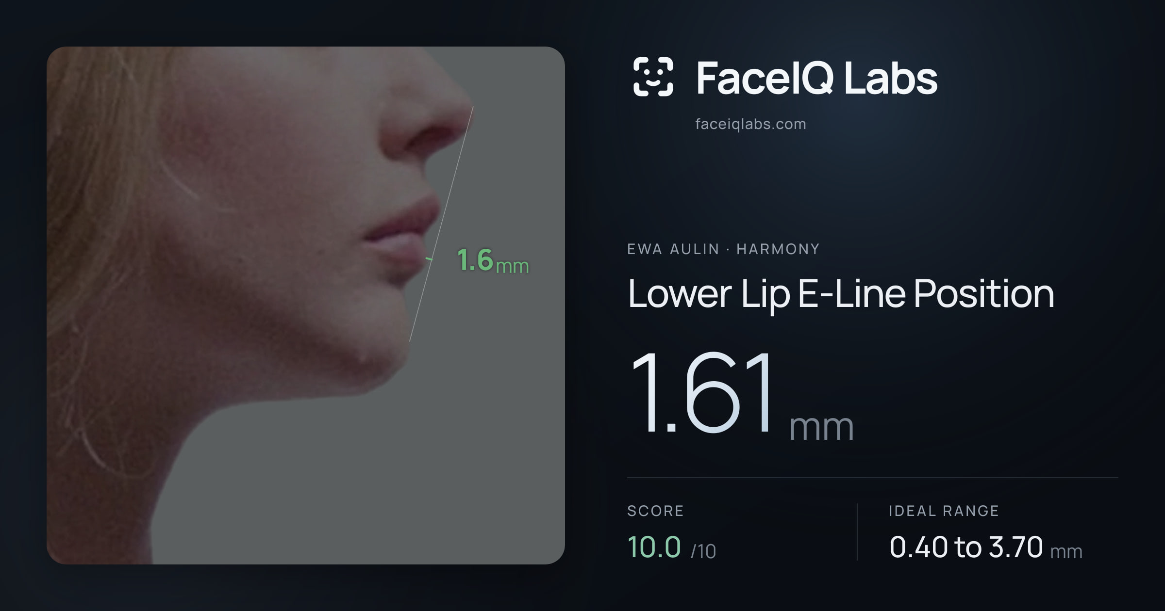 Ewa Aulin Lower Lip E-Line Position: 1.61mm, drawn on the photo