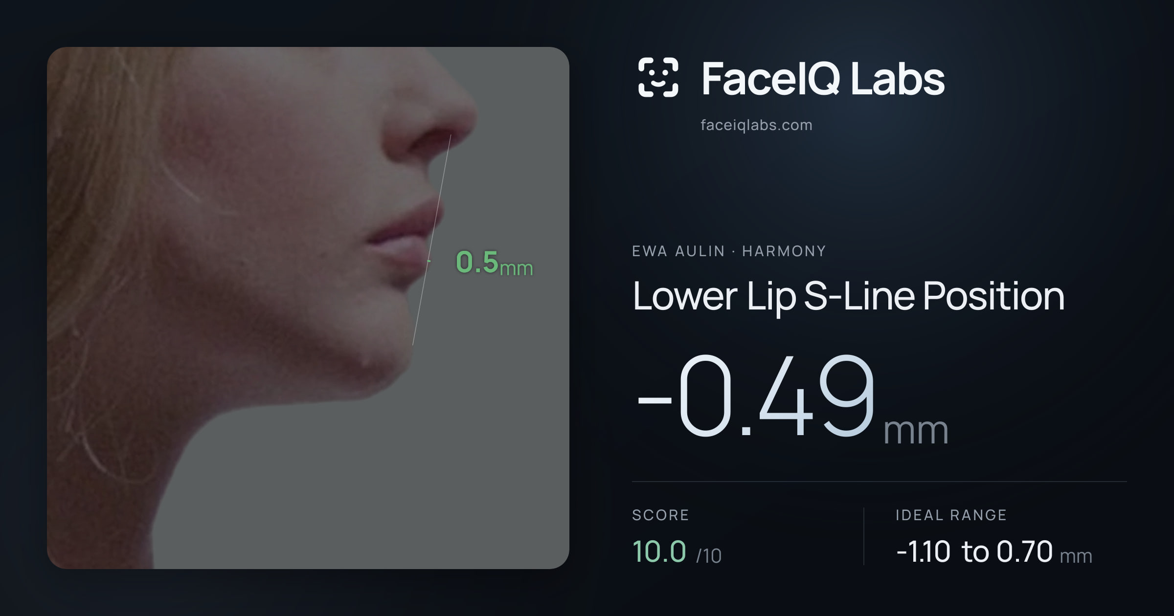 Ewa Aulin Lower Lip S-Line Position: -0.49mm, drawn on the photo