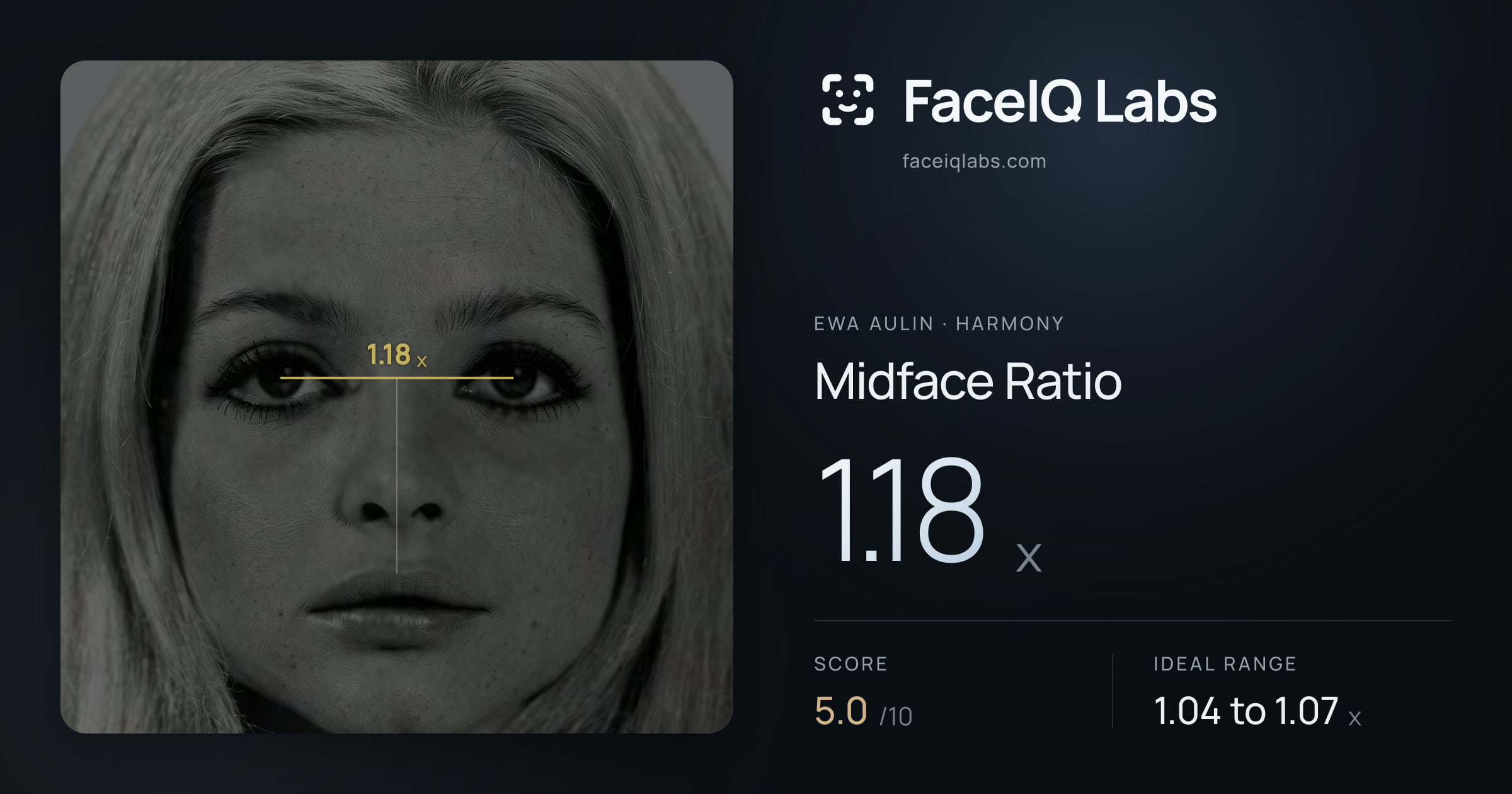 Ewa Aulin Midface Ratio: 1.18x, drawn on the photo