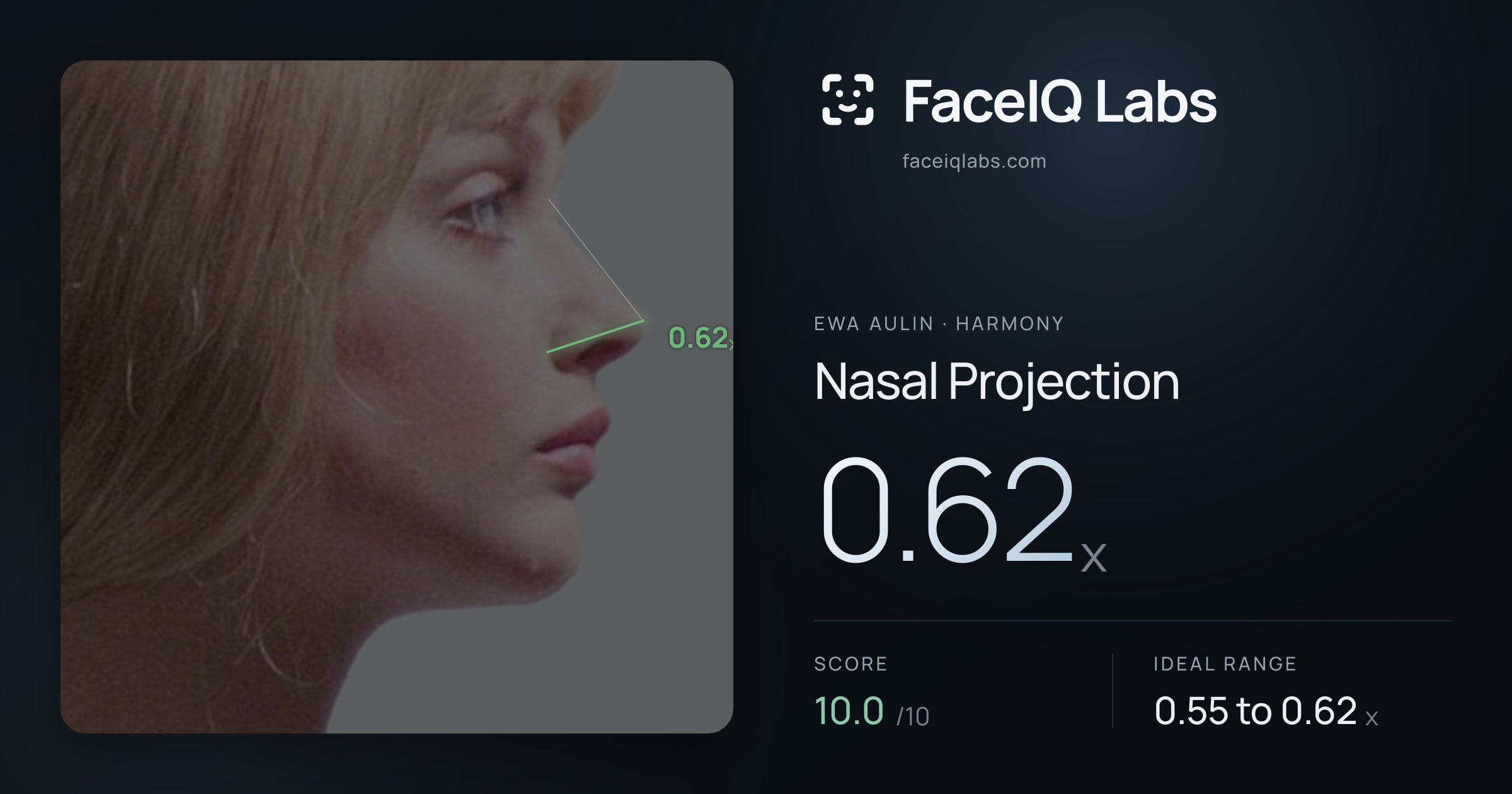 Ewa Aulin Nasal Projection: 0.62x, drawn on the photo