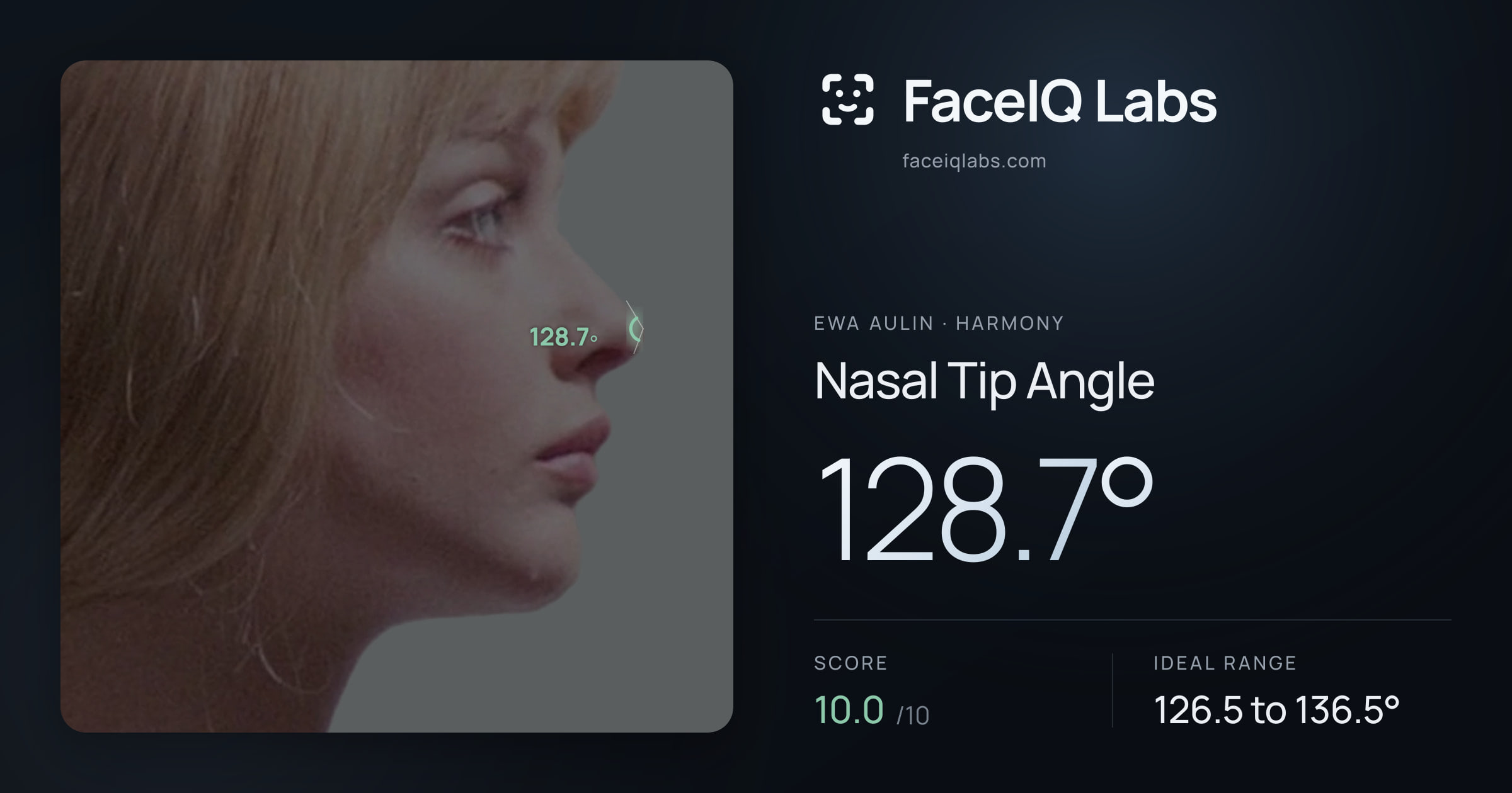 Ewa Aulin Nasal Tip Angle: 128.7°, drawn on the photo