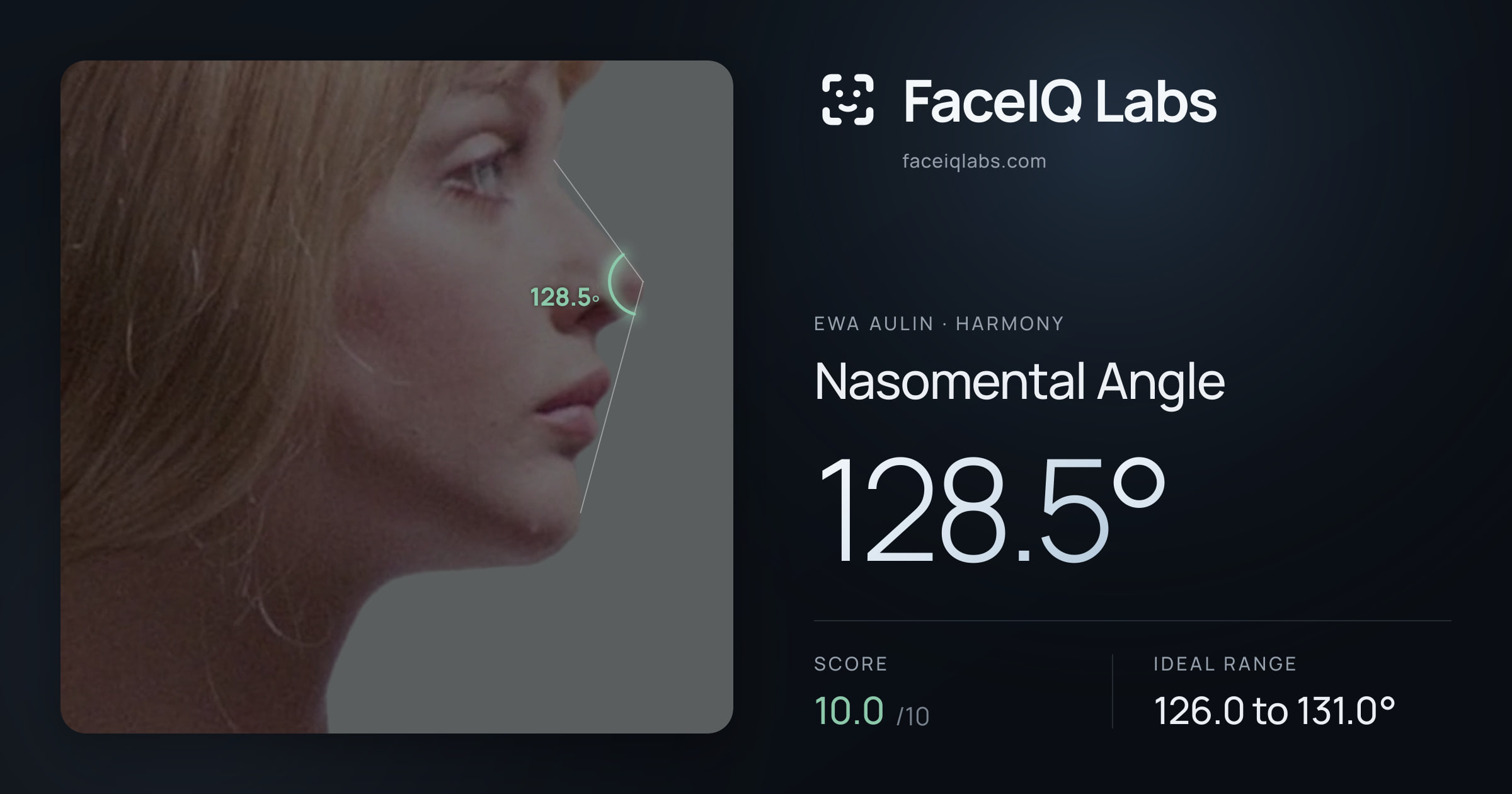 Ewa Aulin Nasomental Angle: 128.5°, drawn on the photo
