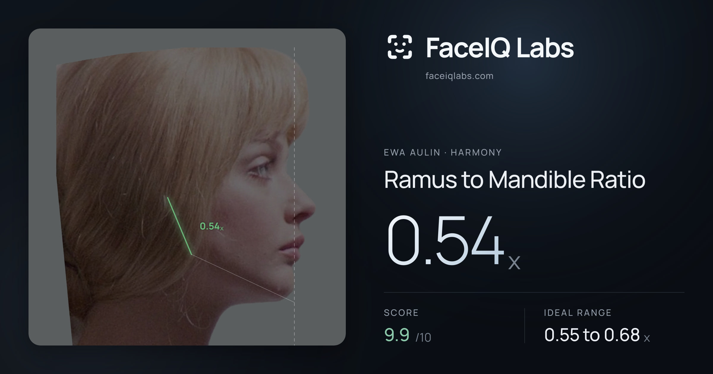 Ewa Aulin Ramus to Mandible Ratio: 0.54x, drawn on the photo