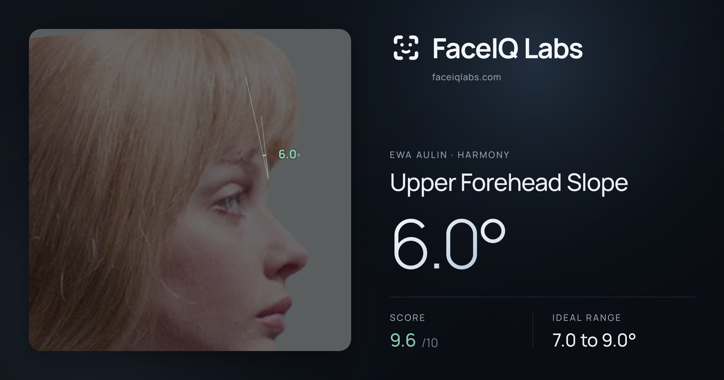 Ewa Aulin Upper Forehead Slope: 6.0°, drawn on the photo