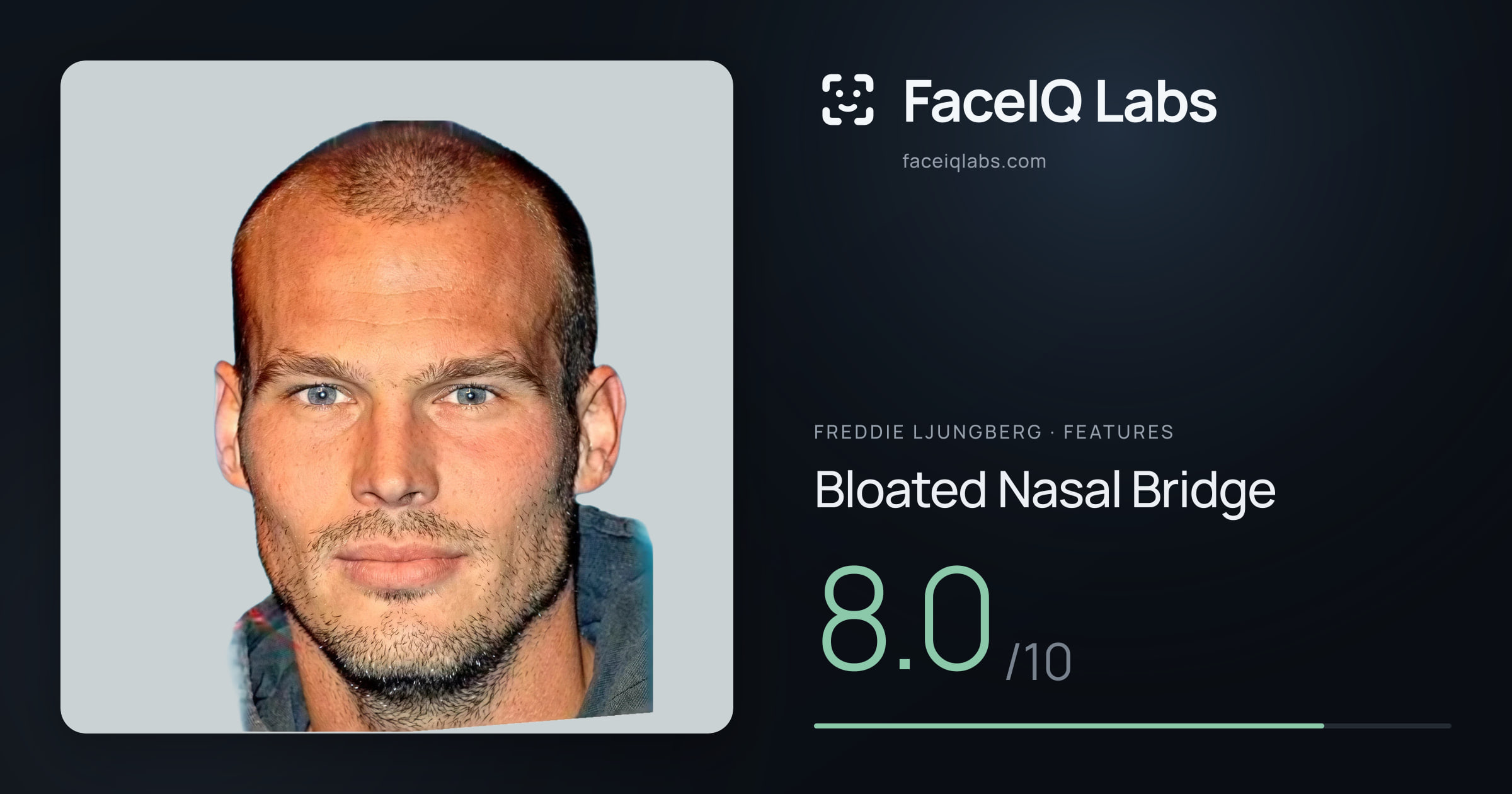 Freddie Ljungberg Bloated Nasal Bridge: 8.0/10, drawn on the photo
