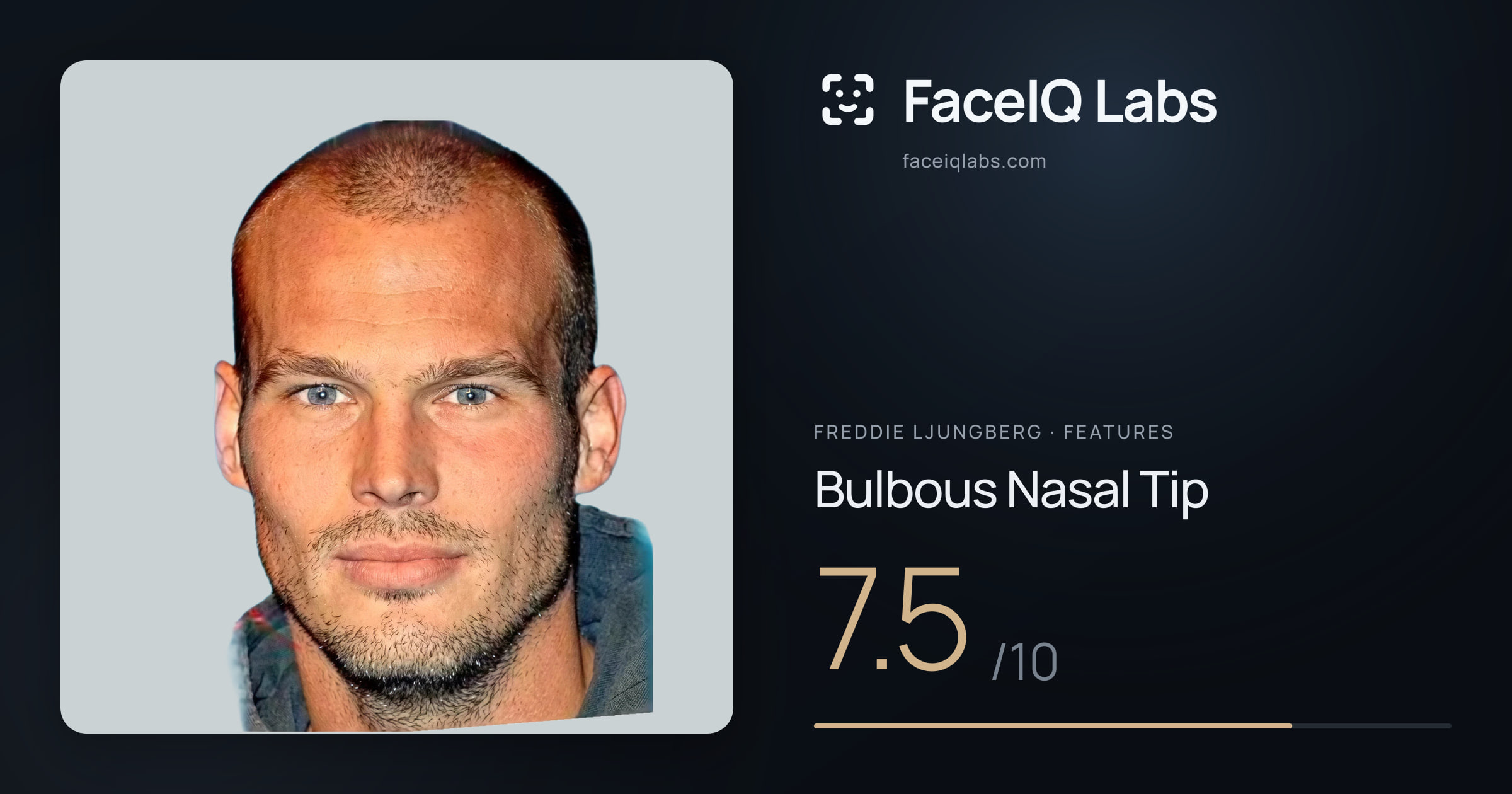 Freddie Ljungberg Bulbous Nasal Tip: 7.5/10, drawn on the photo