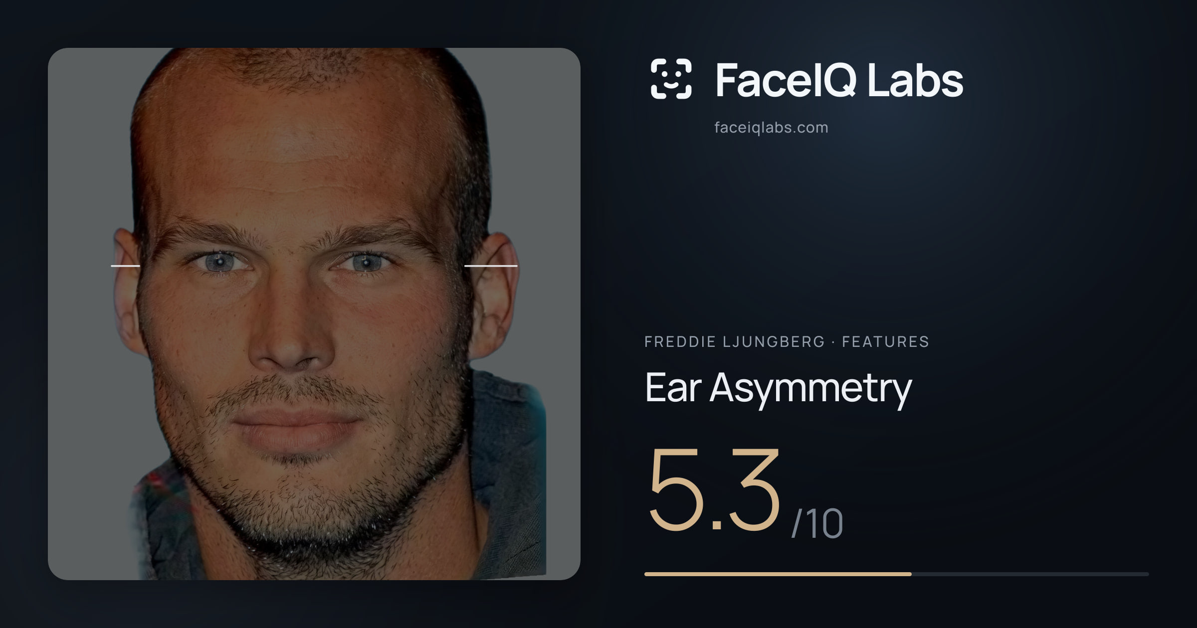 Freddie Ljungberg Ear Asymmetry: 5.3/10, drawn on the photo