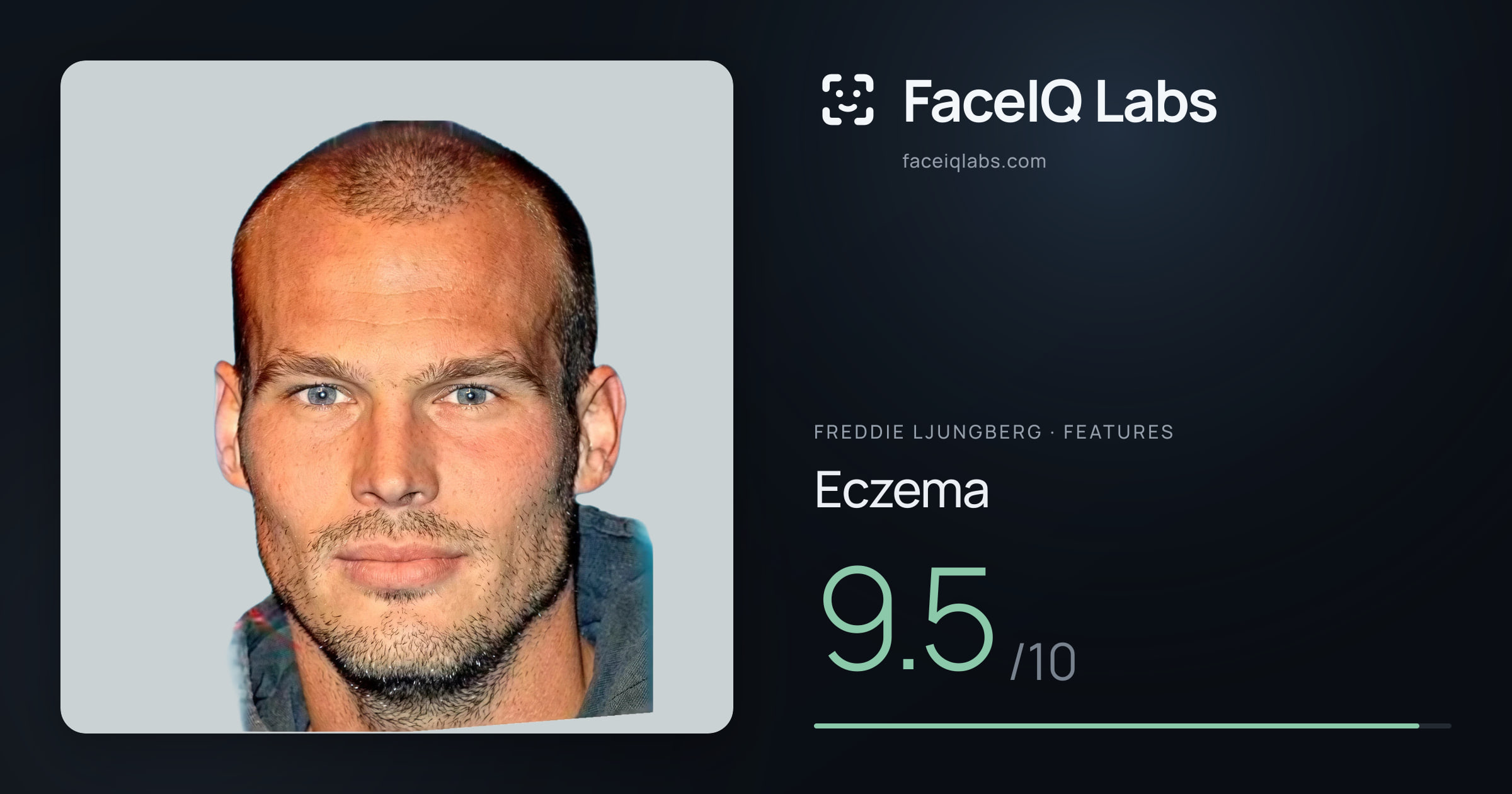 Freddie Ljungberg Eczema: 9.5/10, drawn on the photo