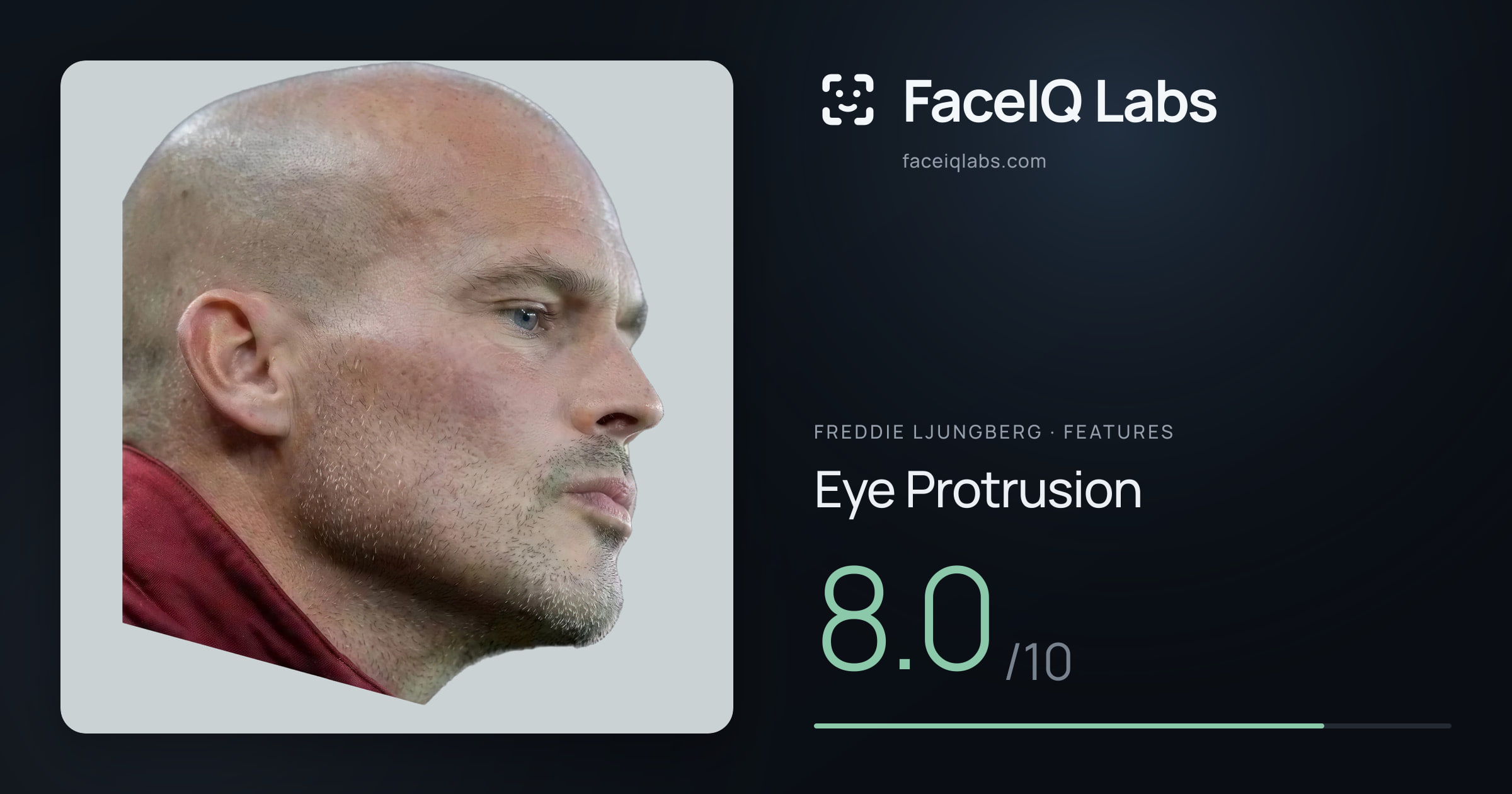 Freddie Ljungberg Eye Protrusion: 8.0/10, drawn on the photo
