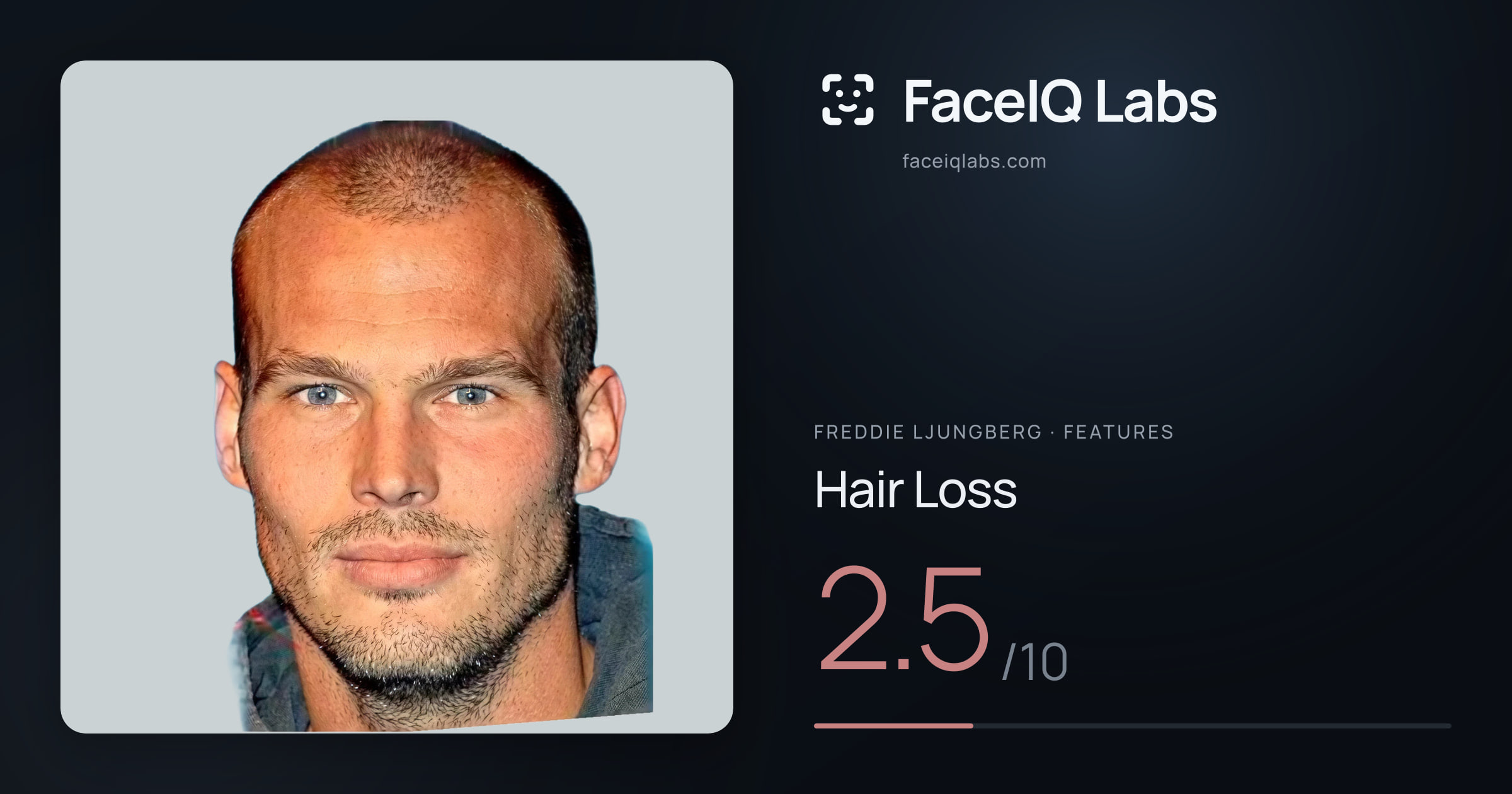Freddie Ljungberg Hair Loss: 2.5/10, drawn on the photo