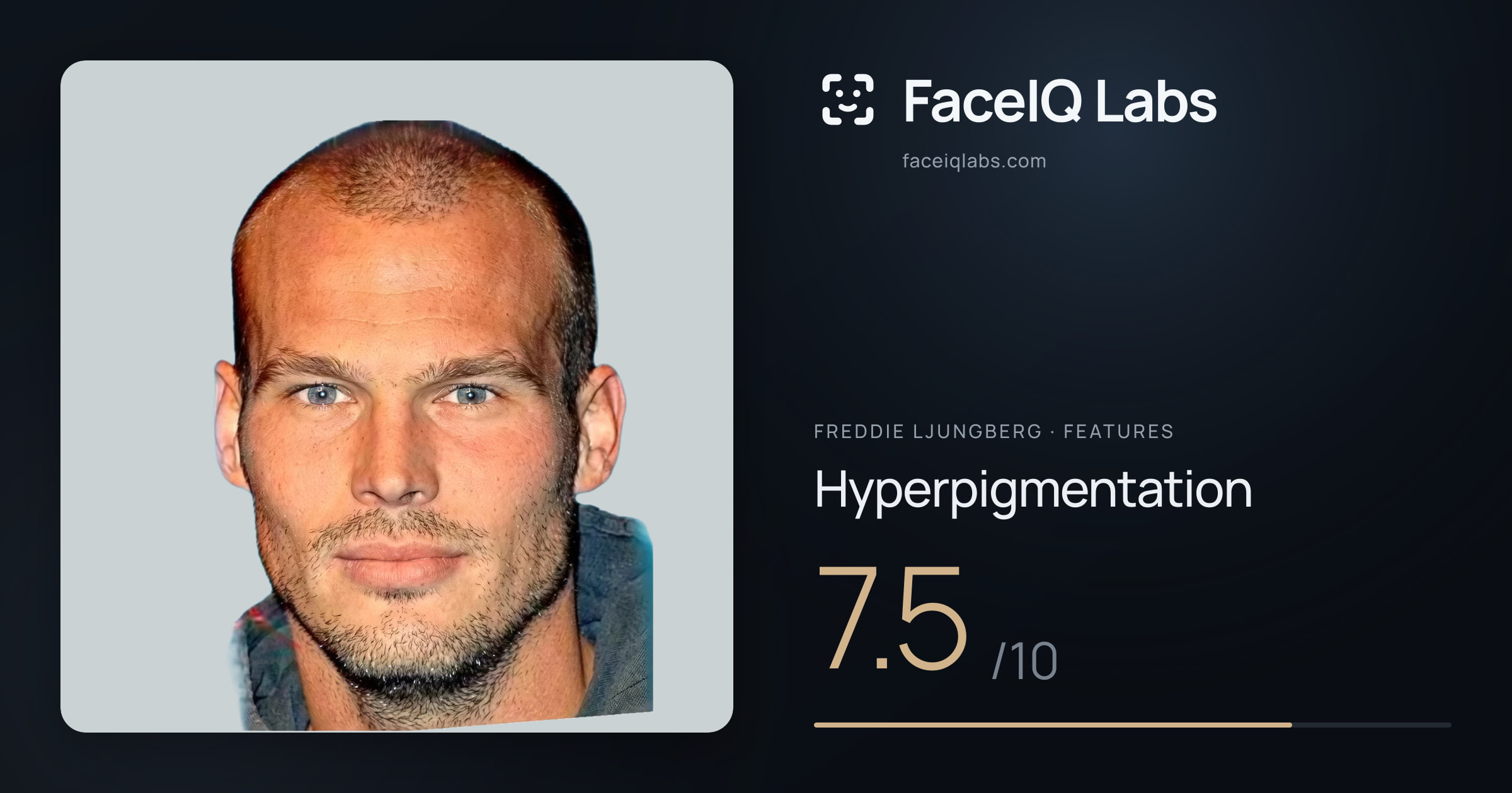 Freddie Ljungberg Hyperpigmentation: 7.5/10, drawn on the photo